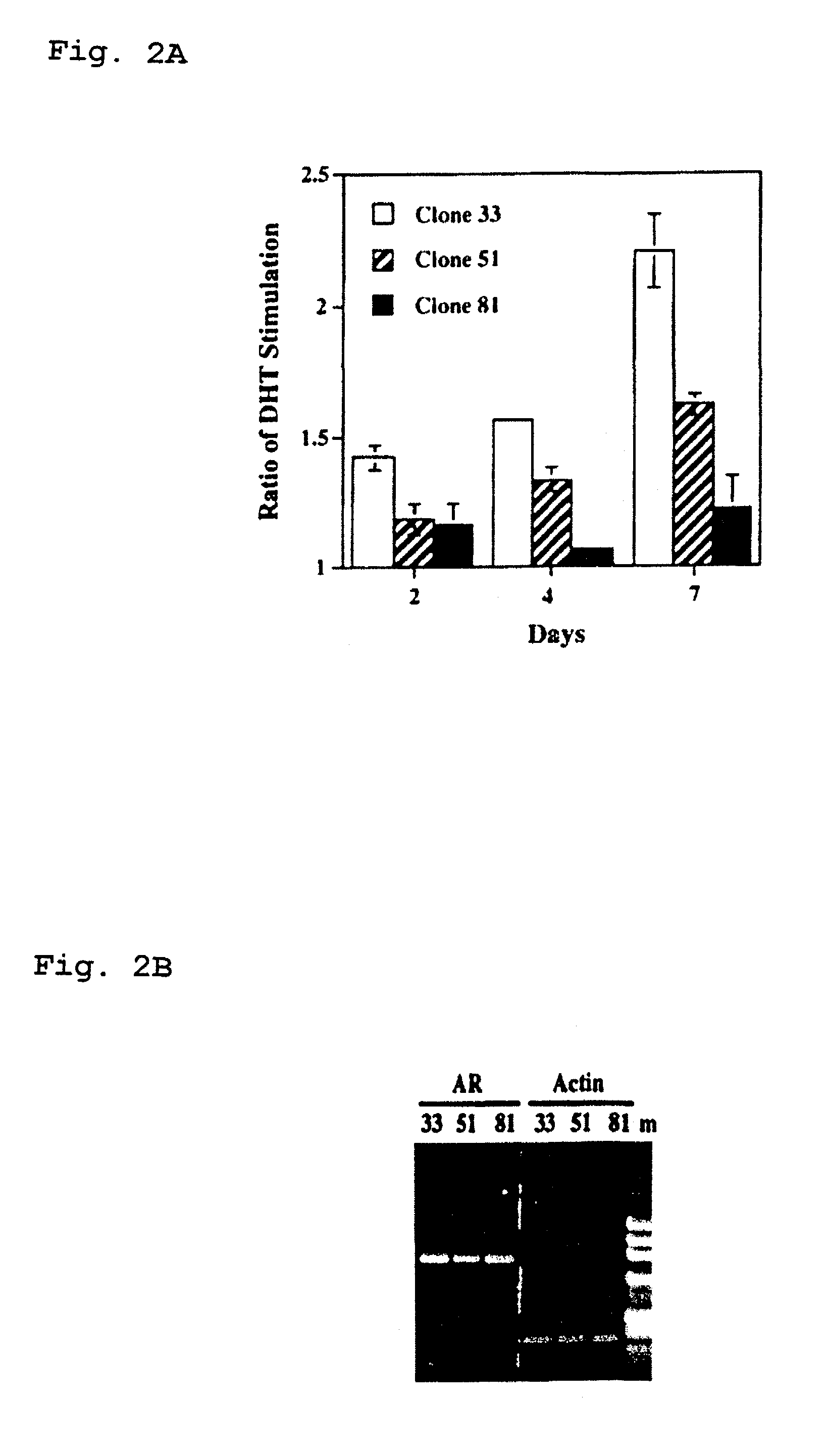 Therapeutic and diagnostic applications of prostatic acid phosphatase in prostate cancer