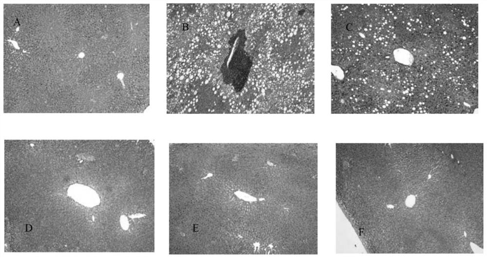 Polypeptide derivative with dual-receptor excitement effect and application of polypeptide derivative