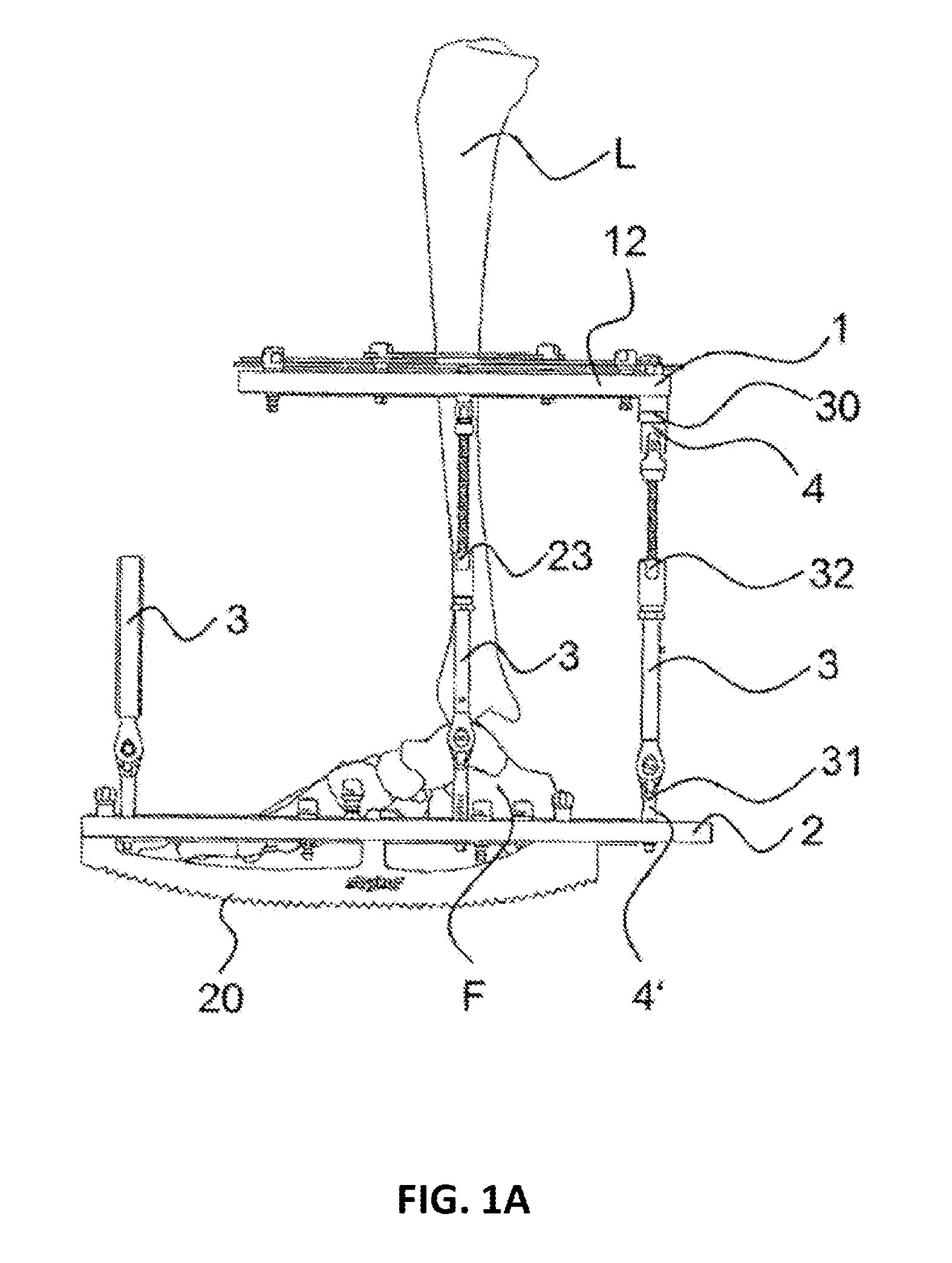 External fixator system