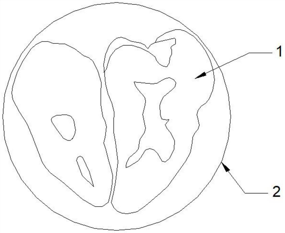 Super-clear visual field diseased tooth specimen and preparation method thereof