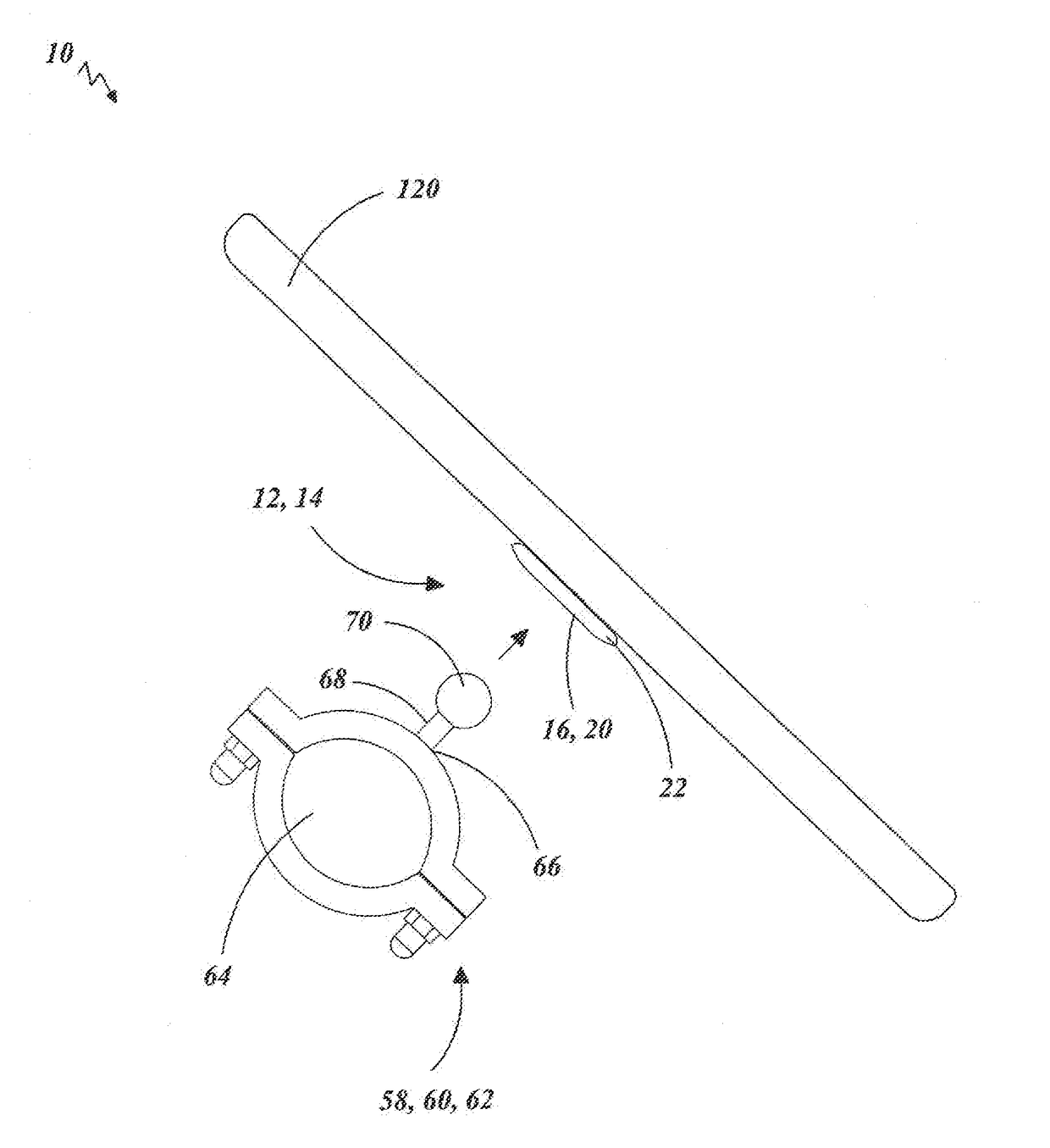 Attachment and Securement System