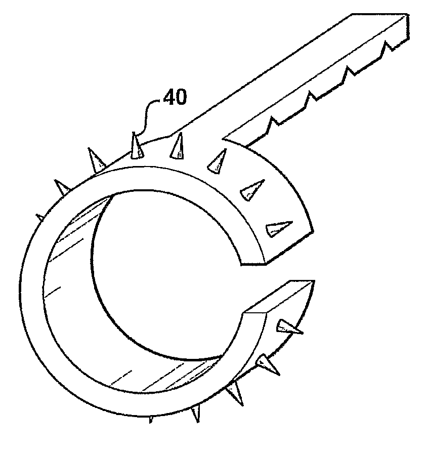 Sutureless vessel anastomosis method and apparatus