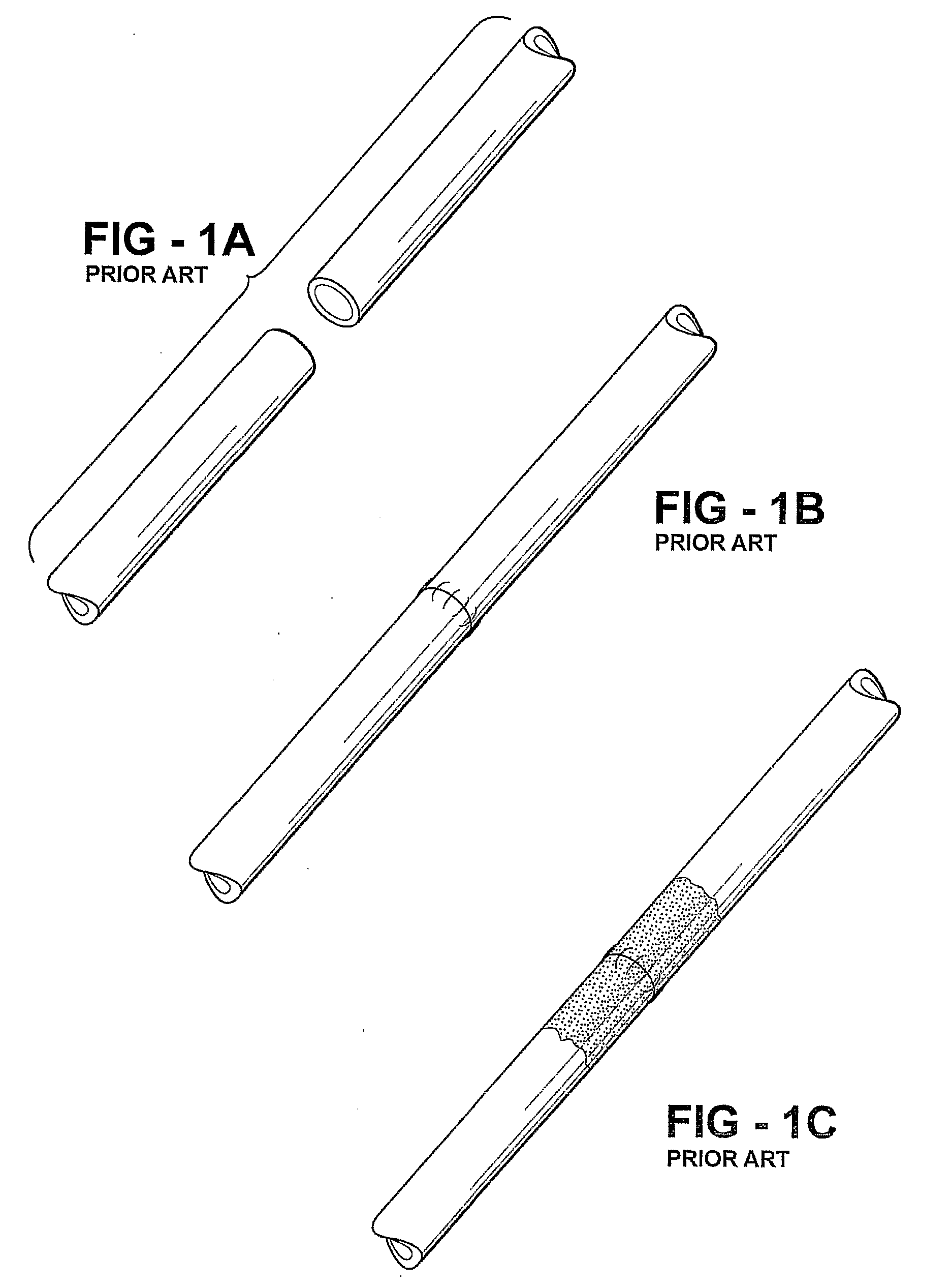 Sutureless vessel anastomosis method and apparatus