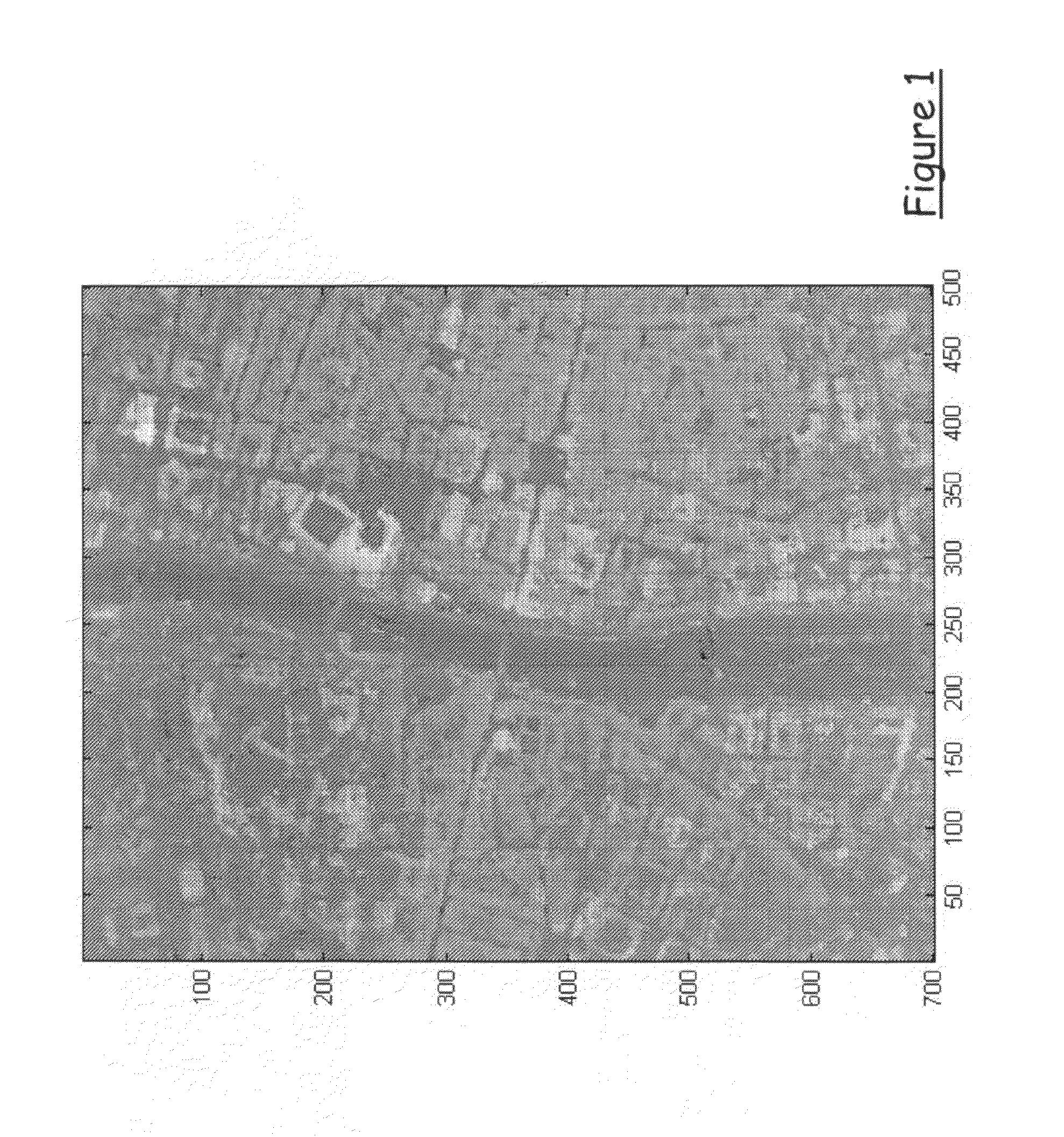 Method of deriving digital terrain models from digital surface models