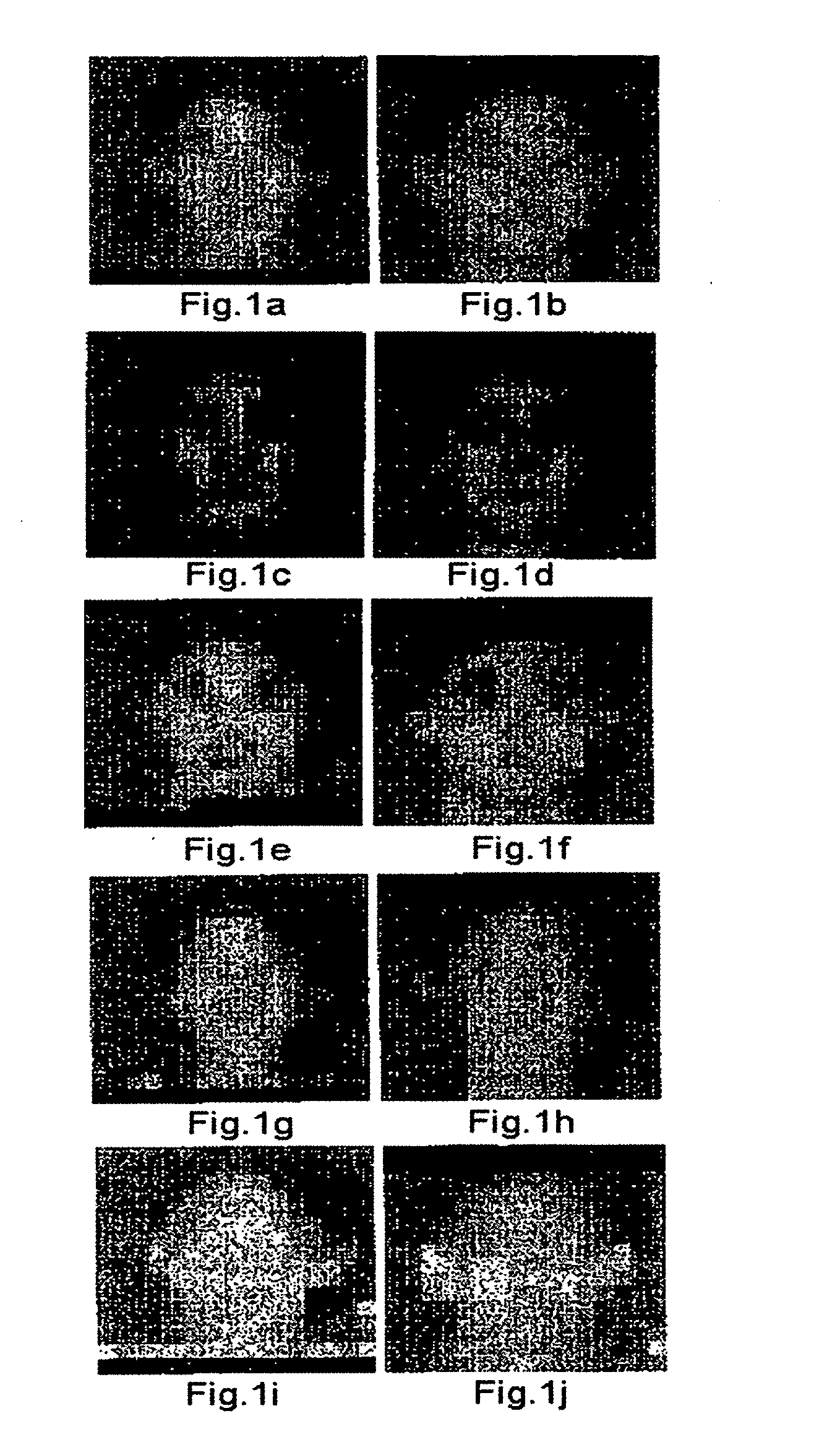 Image interpolation method and apparatus therefor