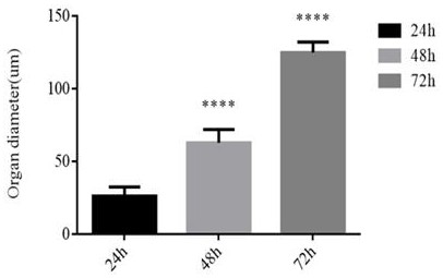 A kind of in vitro construction method and application of liver organoids