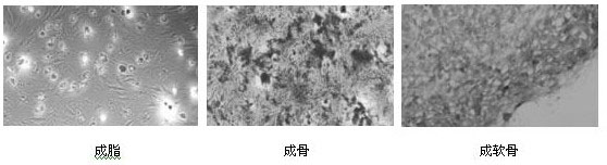 Synovial mesenchymal stem cell and PRP combined preparation for repairing articular cartilage injury as well as preparation method and application thereof