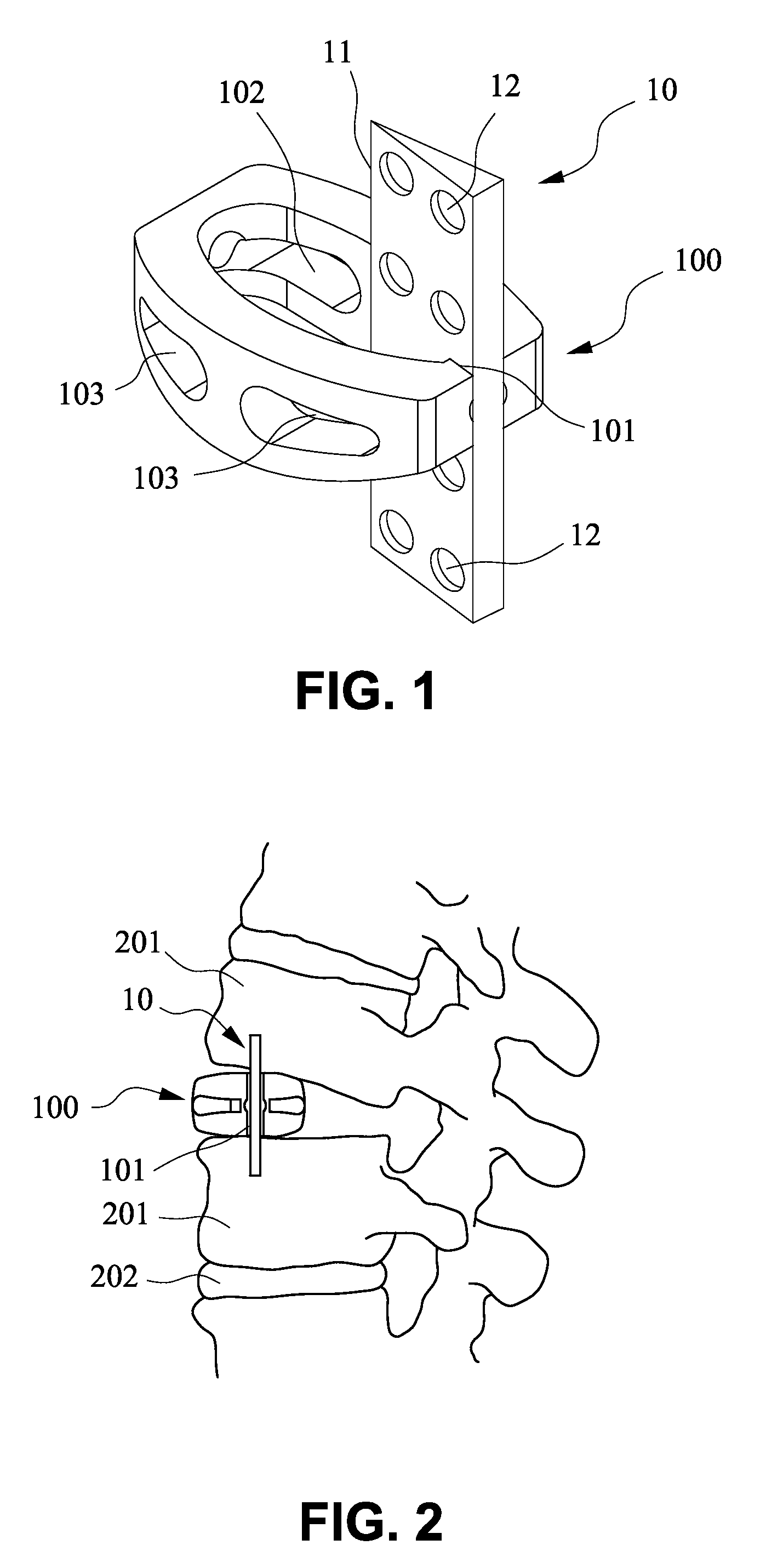 Trans-Vertebral and Intra-Vertebral Plate and Fusion Cage Device for Spinal Interbody Fusion and Method of Operation