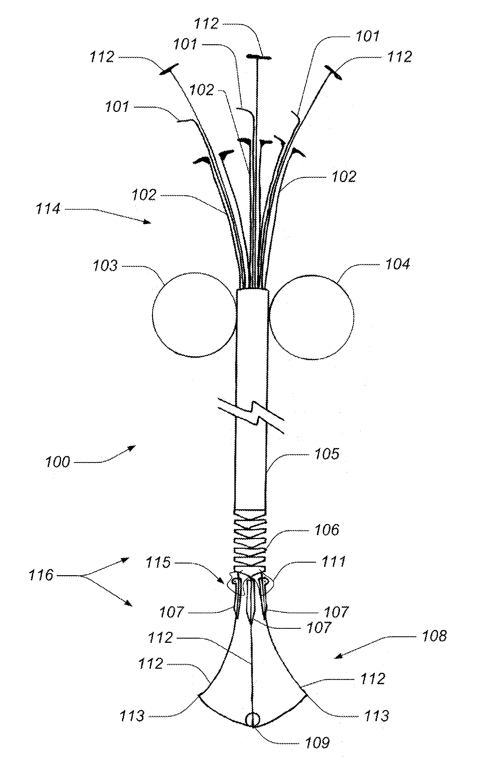 Medical kit for constricting tissue or a bodily orifice, for example, a mitral valve