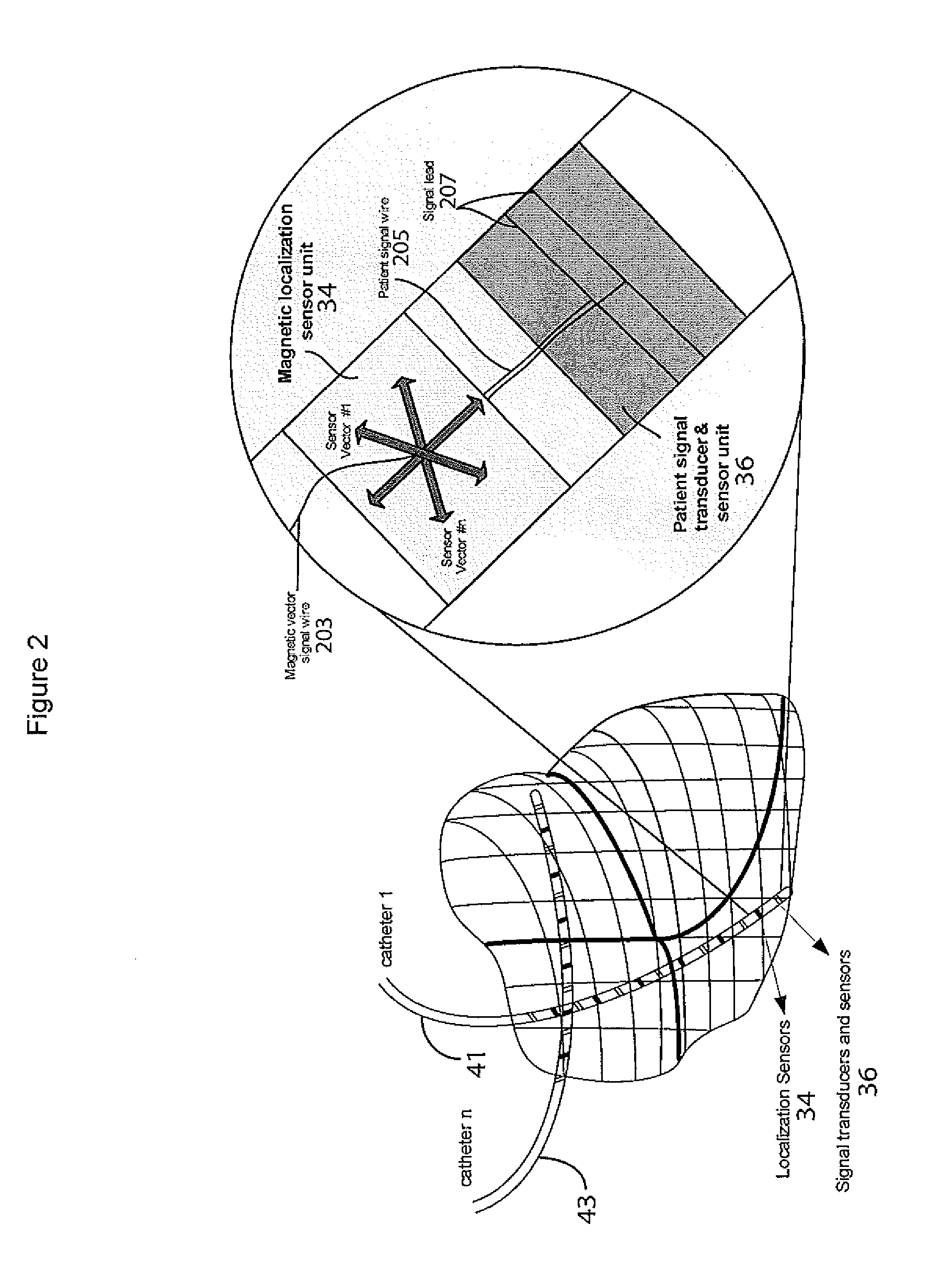 System For Continuous Cardiac Imaging And Mapping