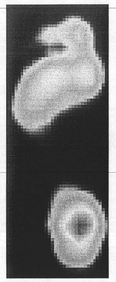 Method for biophysical analysis and identification of human body based on pressure accumulated footprint image