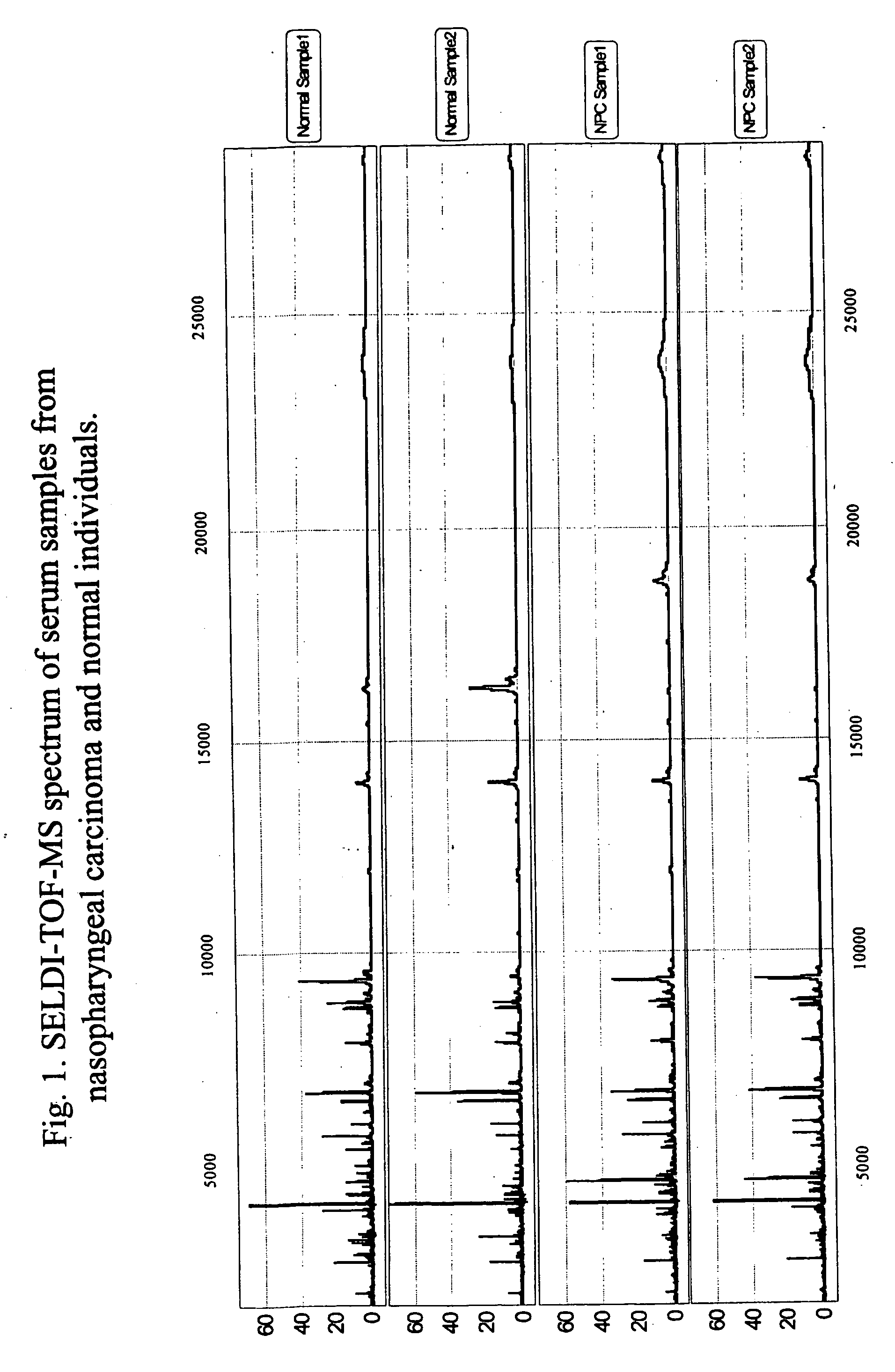 Methods and compositions for detection of nasopharyngeal carcinoma