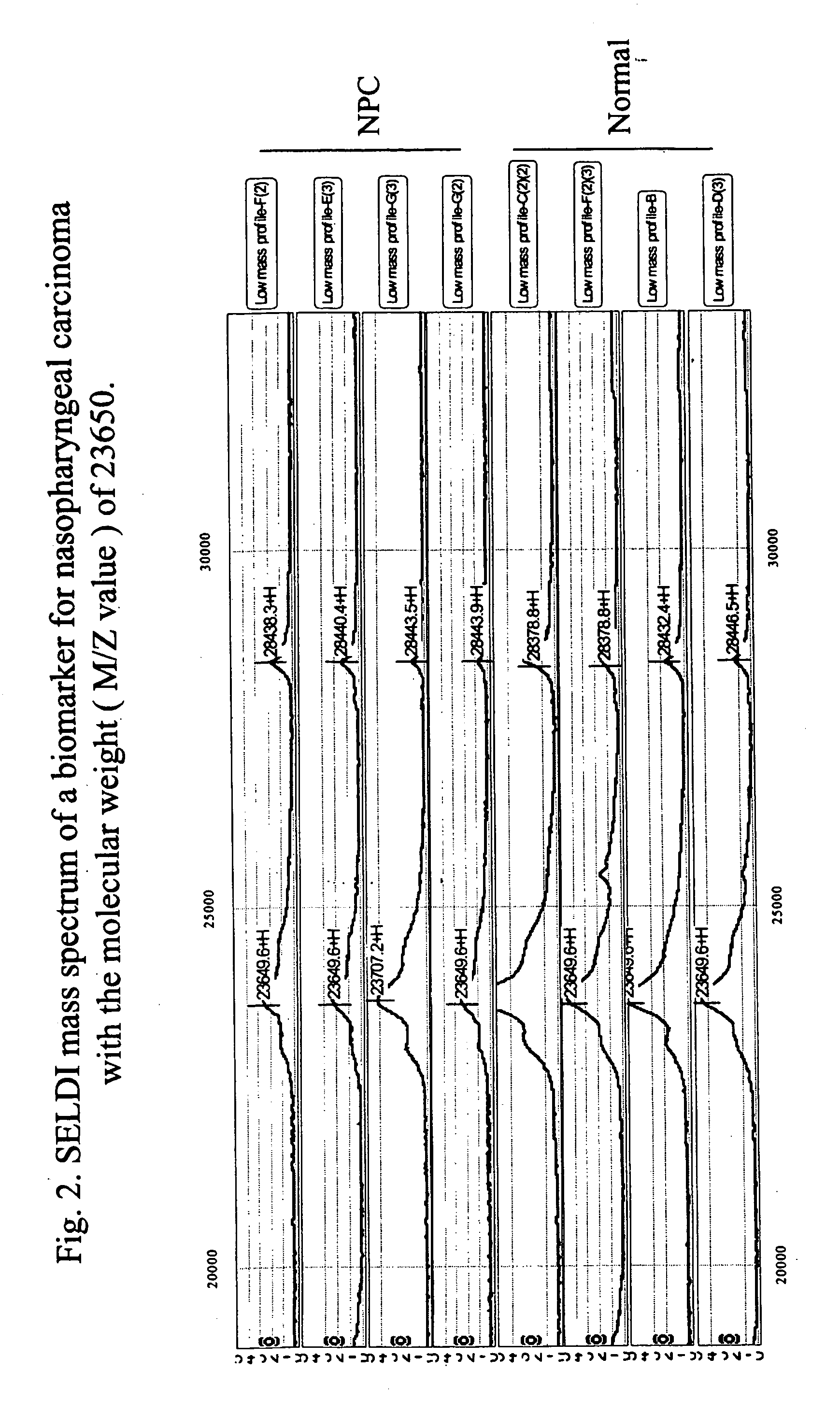 Methods and compositions for detection of nasopharyngeal carcinoma
