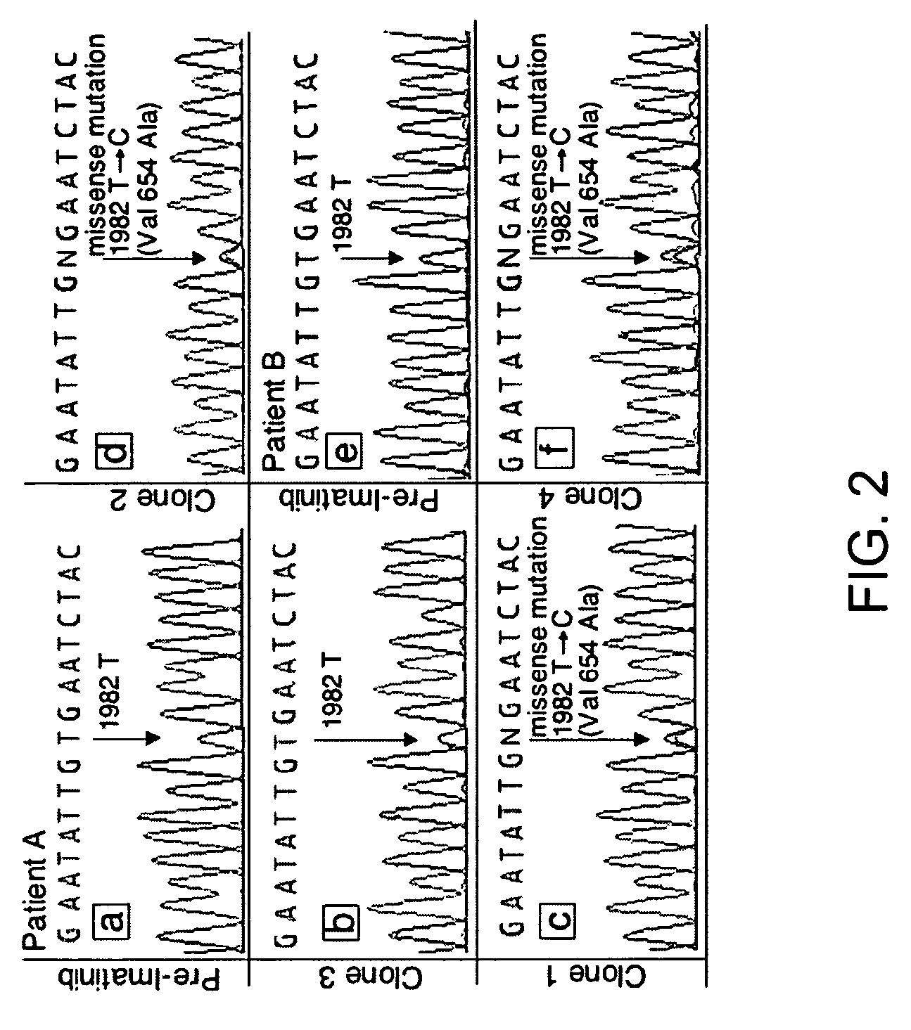 Mutations in KIT confer imatinib resistance in gastrointestinal stromal tumors