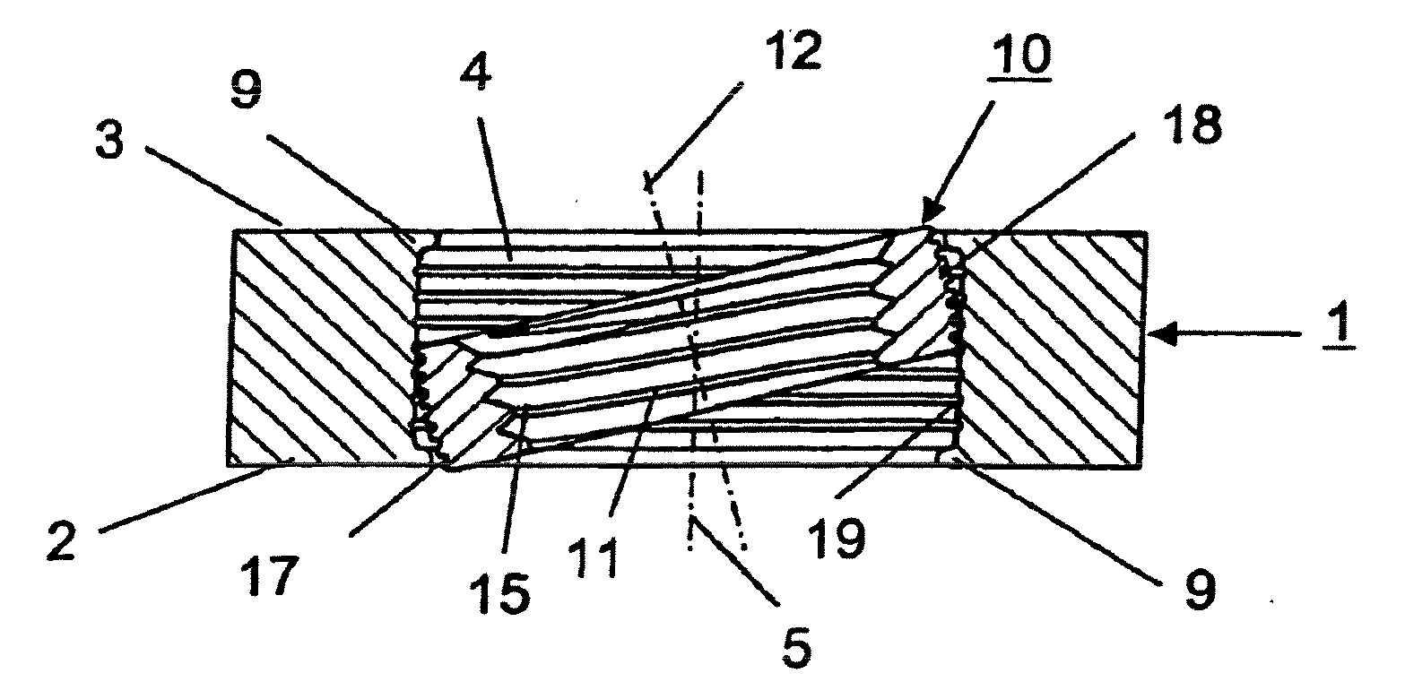 Device for osteosynthesis