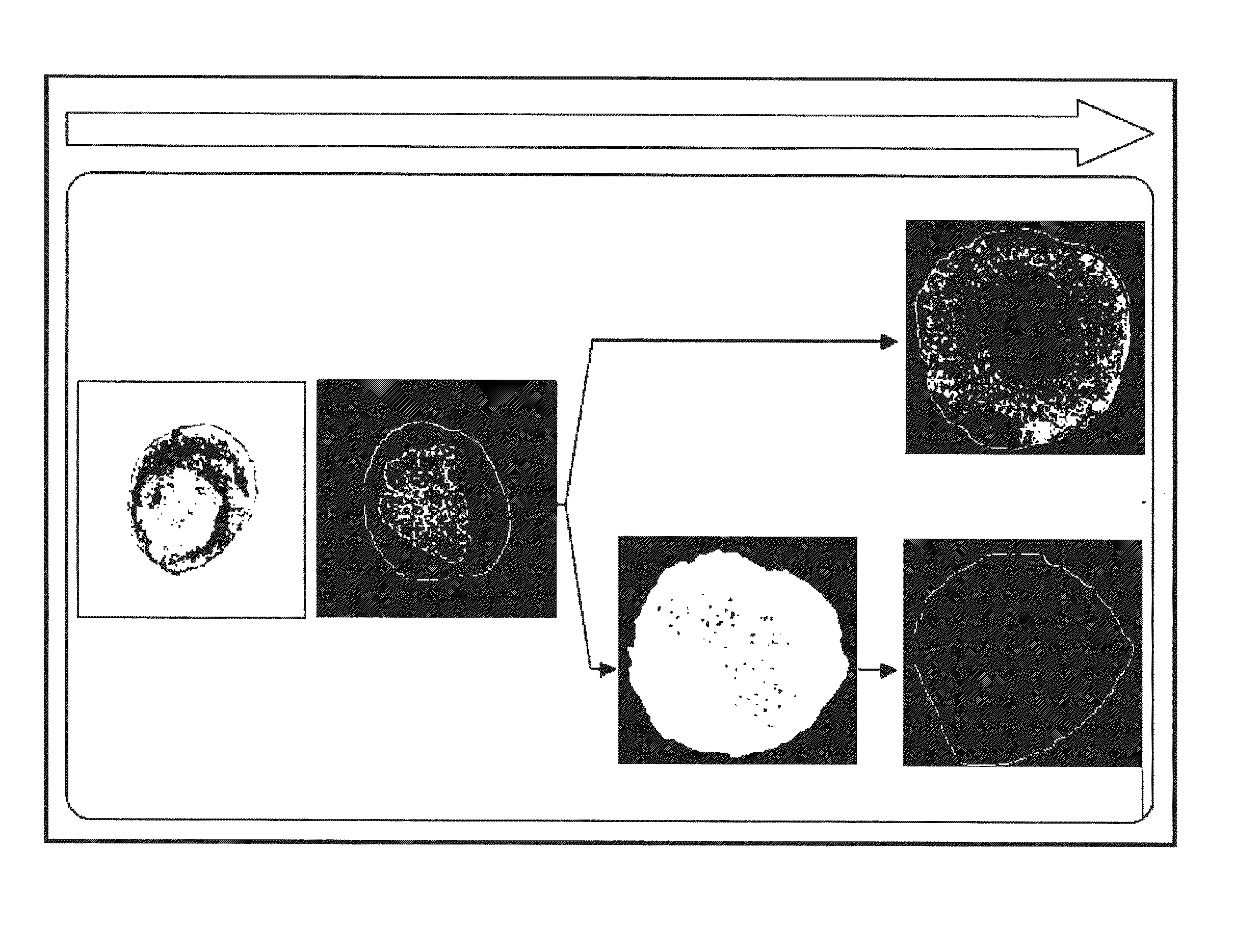 Method for obtaining ngn3-expressing cells and insulin producing-beta cells