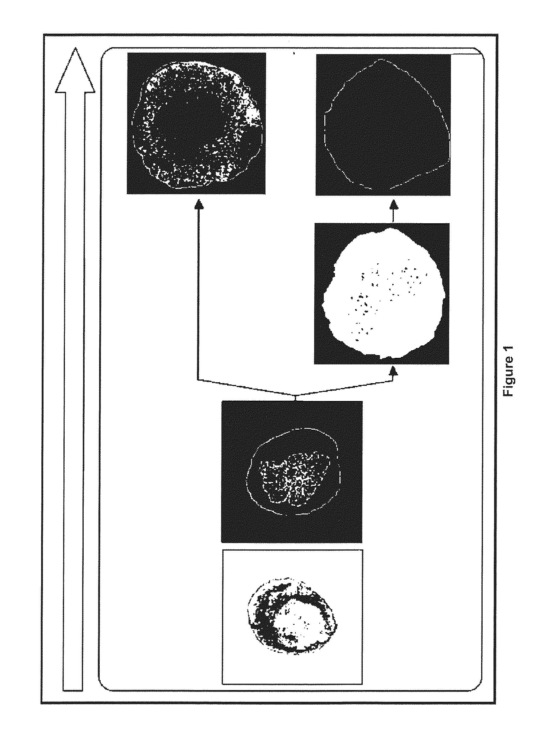 Method for obtaining ngn3-expressing cells and insulin producing-beta cells