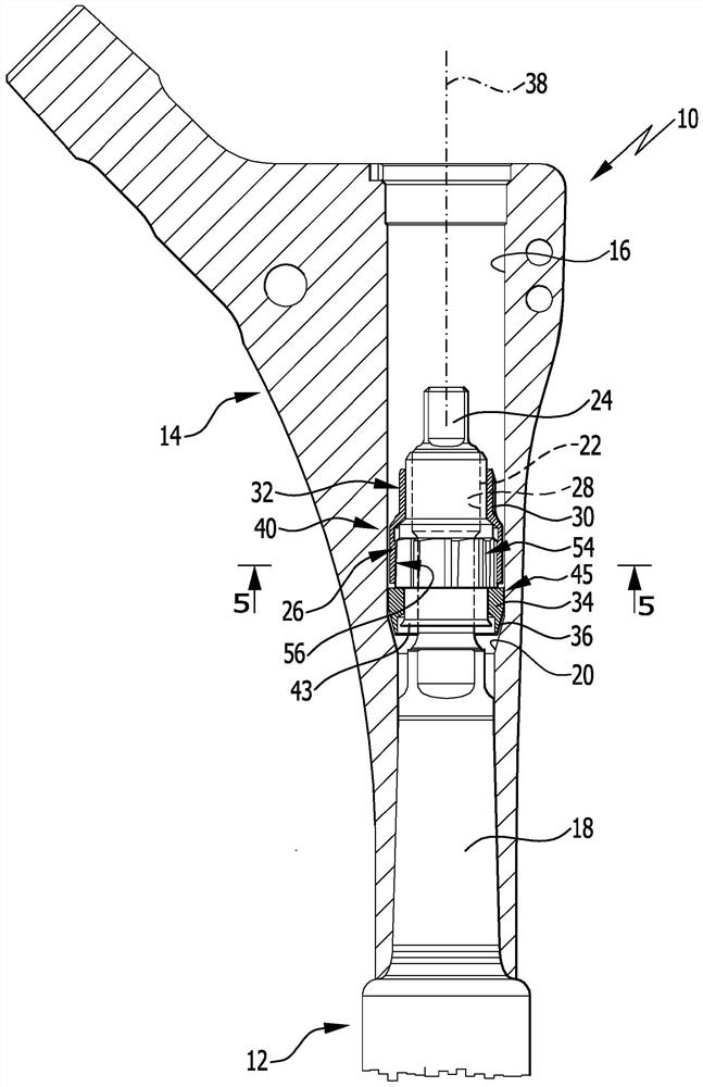 Implant