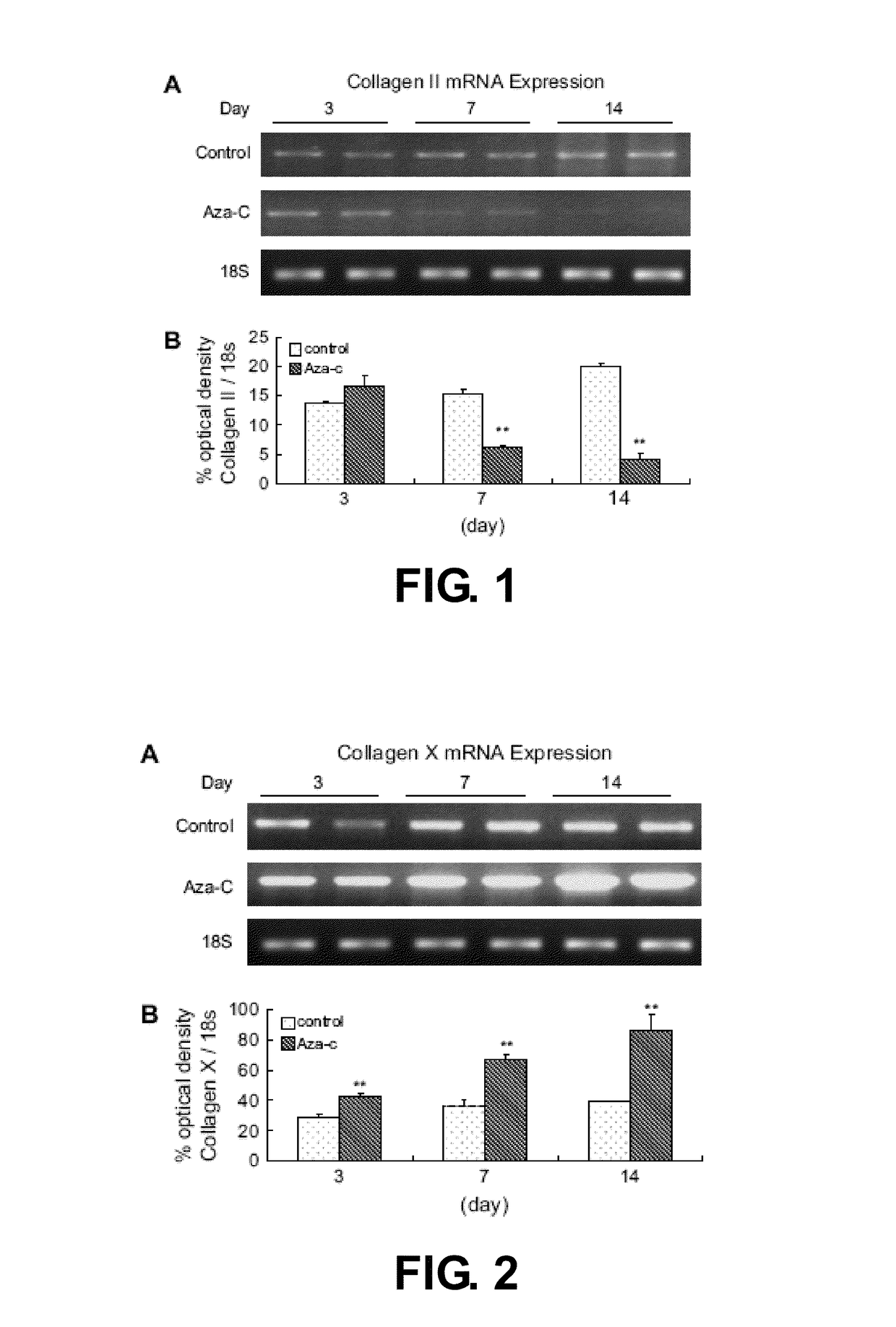 Three-dimensional culture containing human articular chondrocytes with induced terminal differentiation changes and preparation process and uses of the same