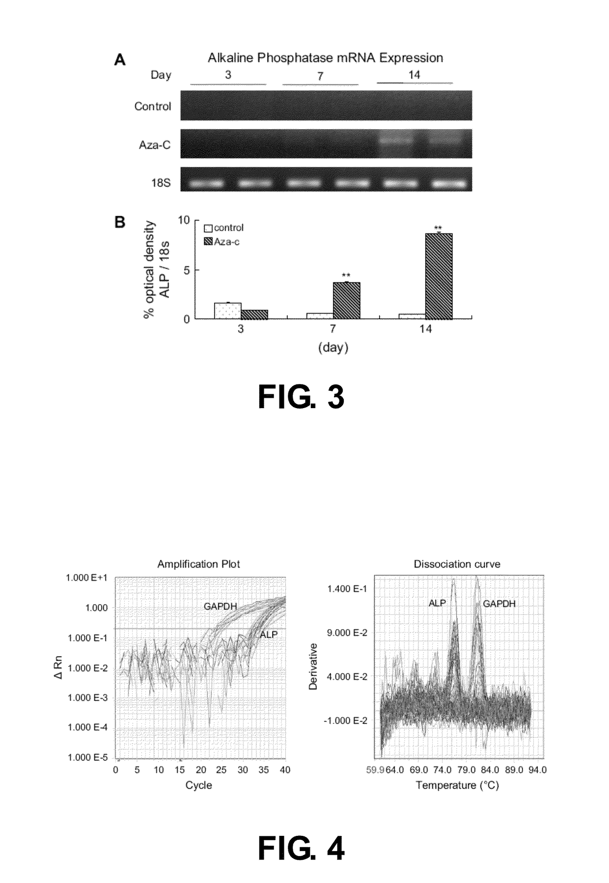 Three-dimensional culture containing human articular chondrocytes with induced terminal differentiation changes and preparation process and uses of the same