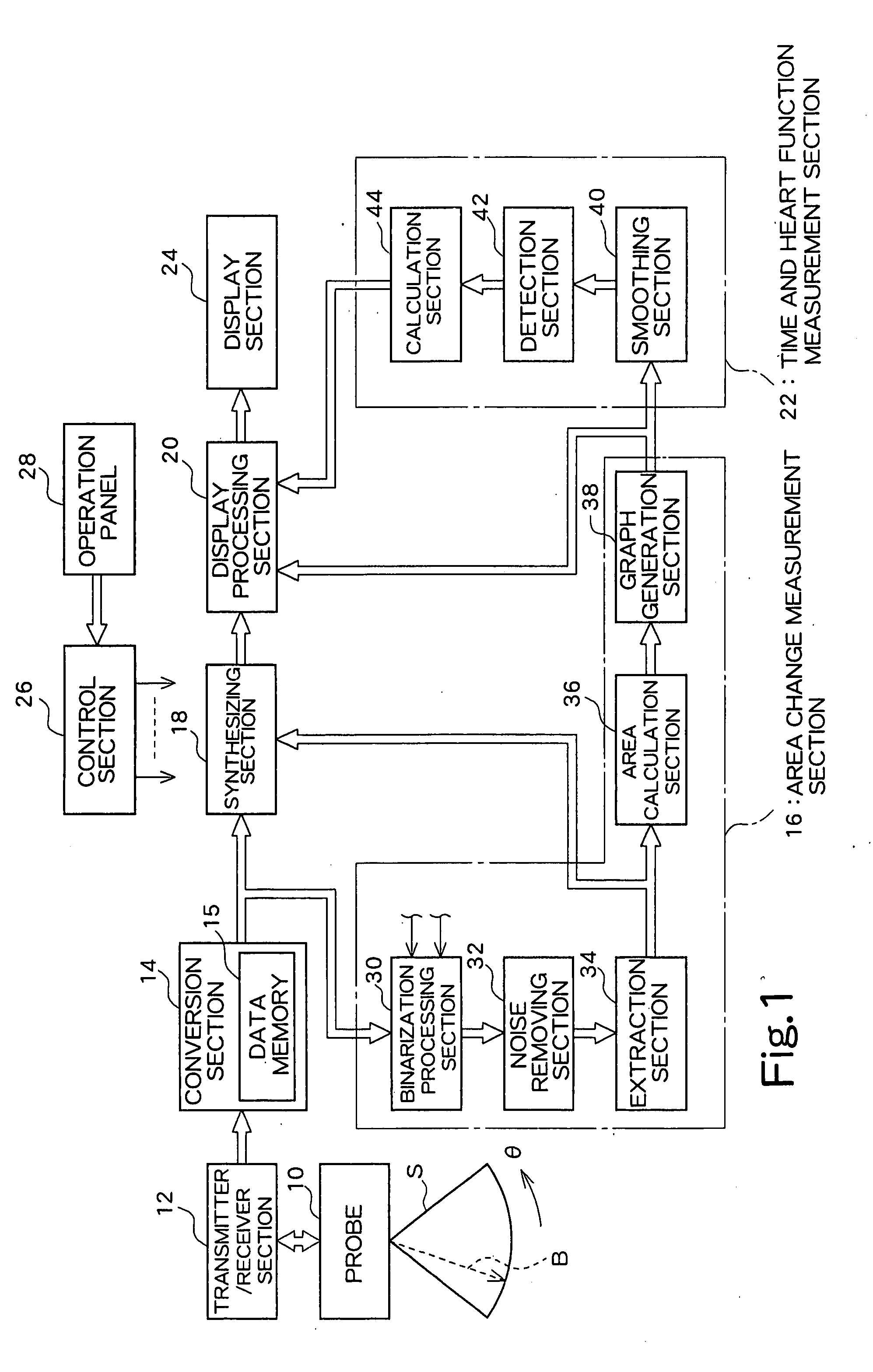 Ultrasound diagnosis apparatus