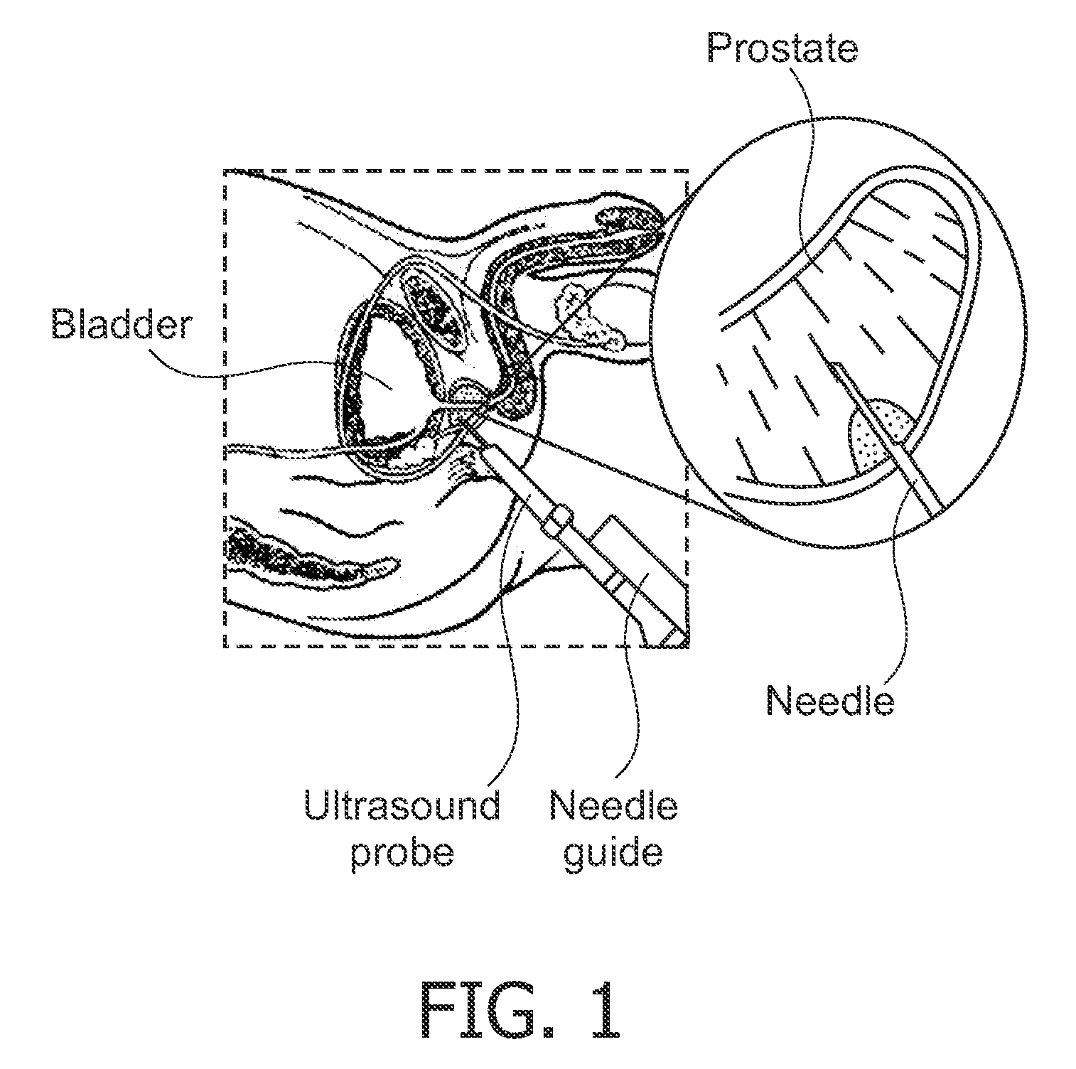 Biopsy device with acoustic element