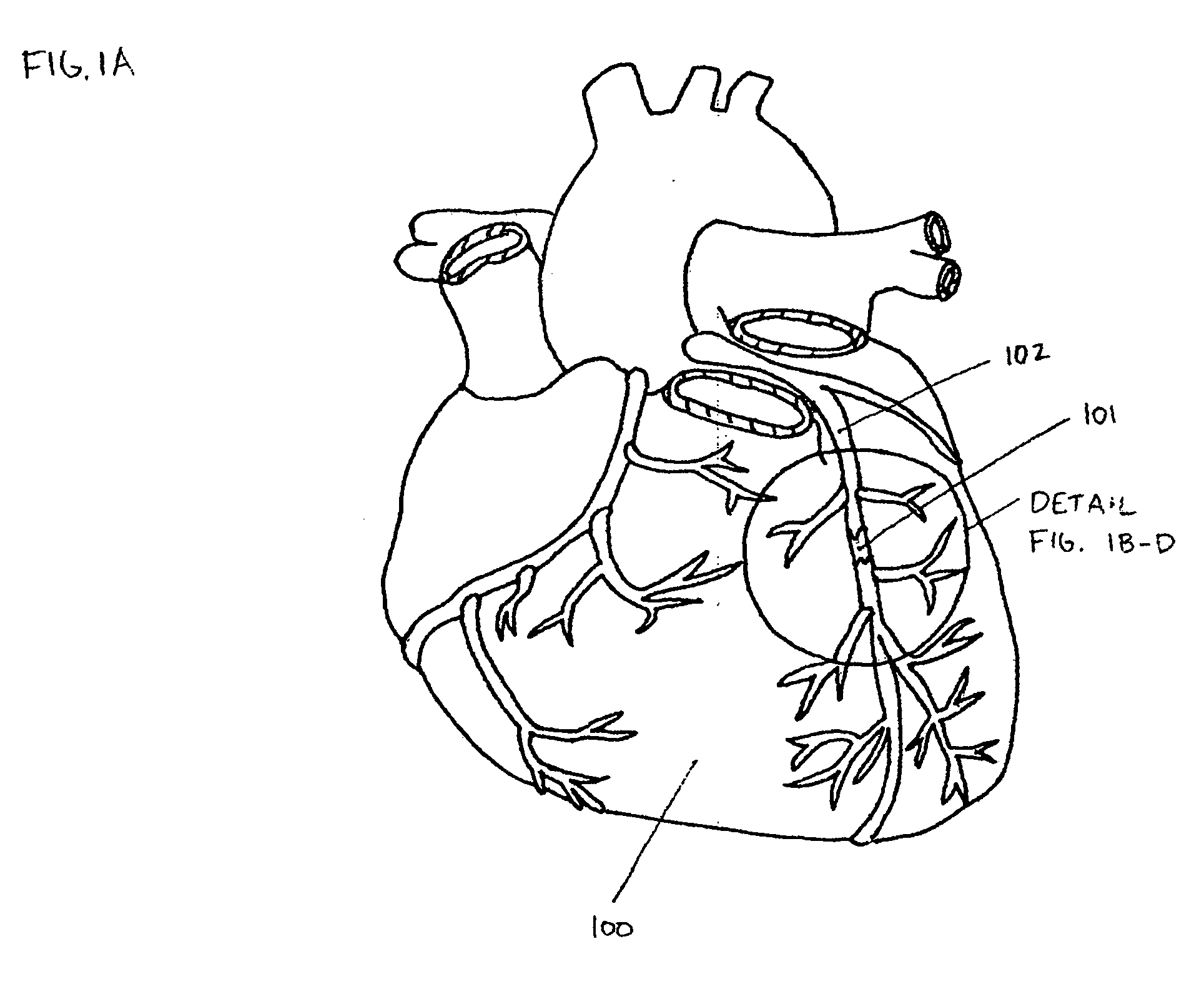 Endovascular devices and methods