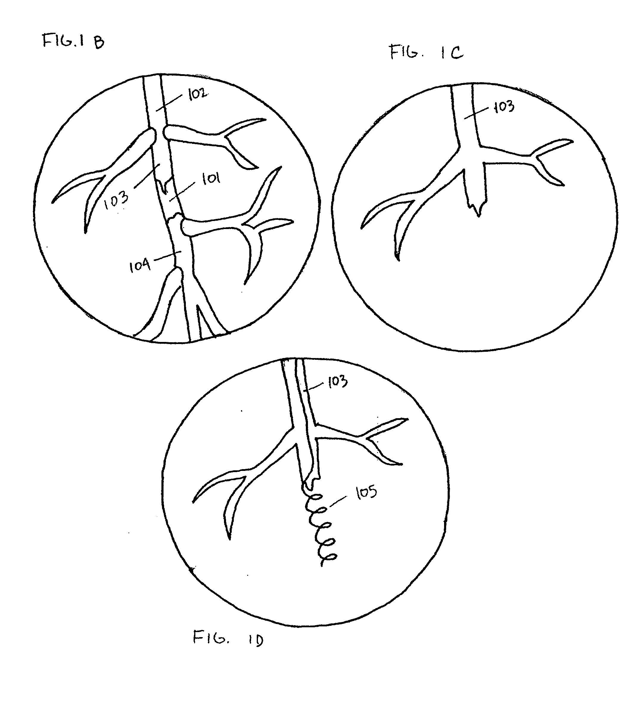 Endovascular devices and methods