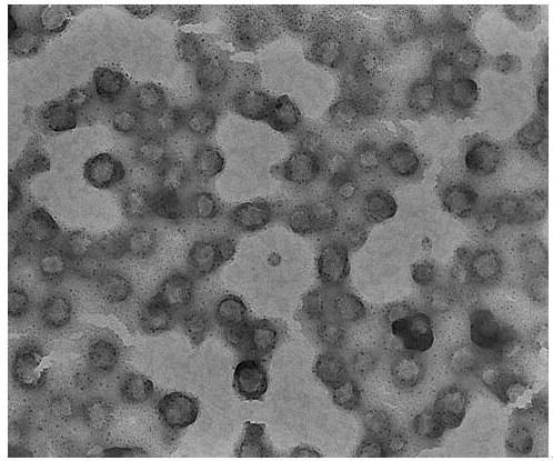 Endoplasmic reticulum membrane fusion liposome as well as preparation method and application thereof