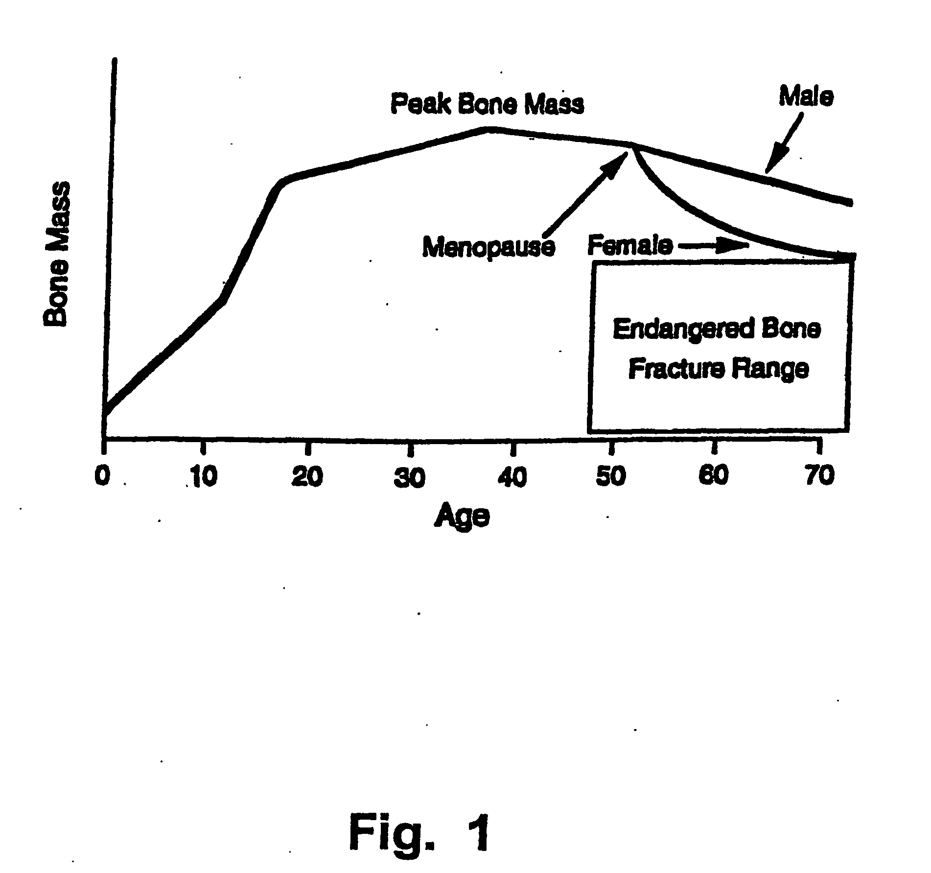 Dental products comprising bone growth enhancing peptide