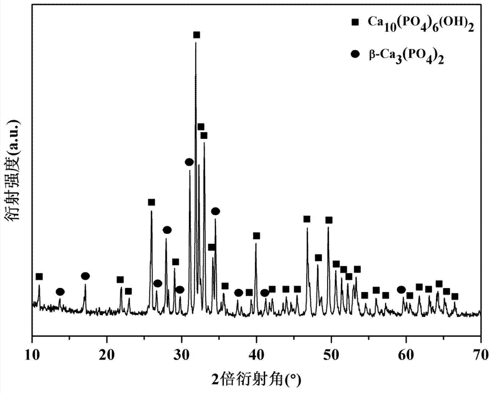 Graphene/dual-phase calcium phosphate composite material and preparation method thereof