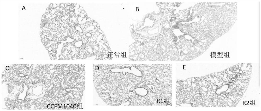 A strain of Lactobacillus reuteri that can relieve allergic asthma and its application