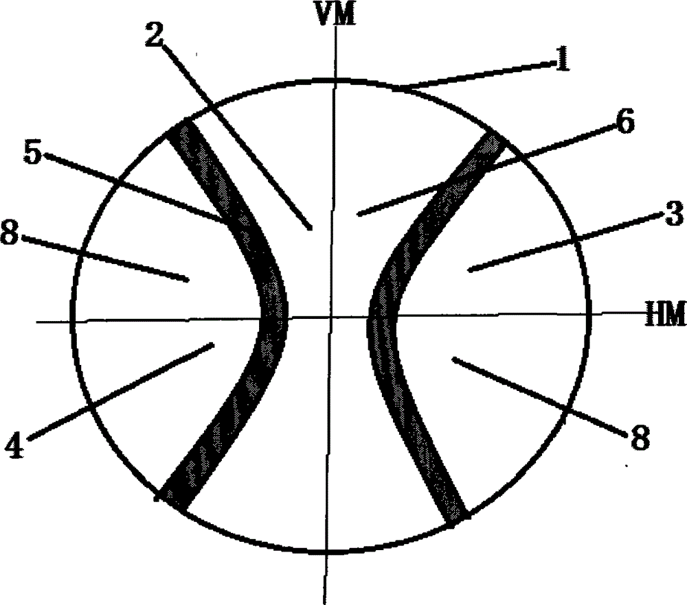 Peripheral out-of-focus frame eyeglass lens with functional area asymmetric correction quantity