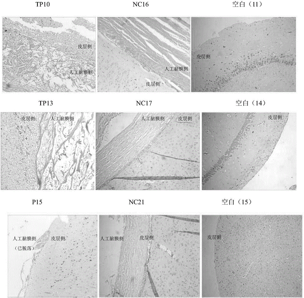 Dura graft, preparation method and applications in dural damage repair thereof