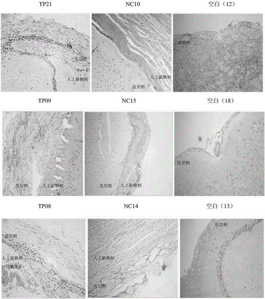 Dura graft, preparation method and applications in dural damage repair thereof