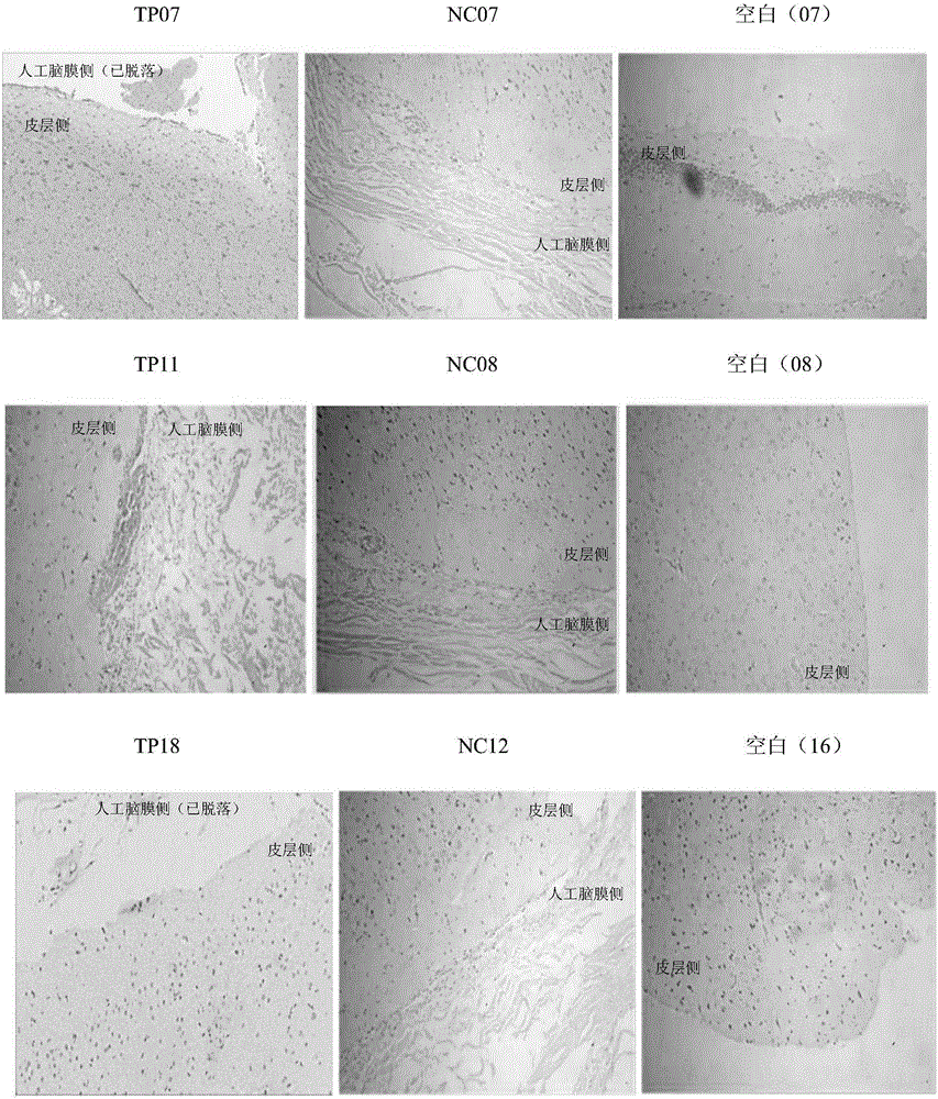 Dura graft, preparation method and applications in dural damage repair thereof