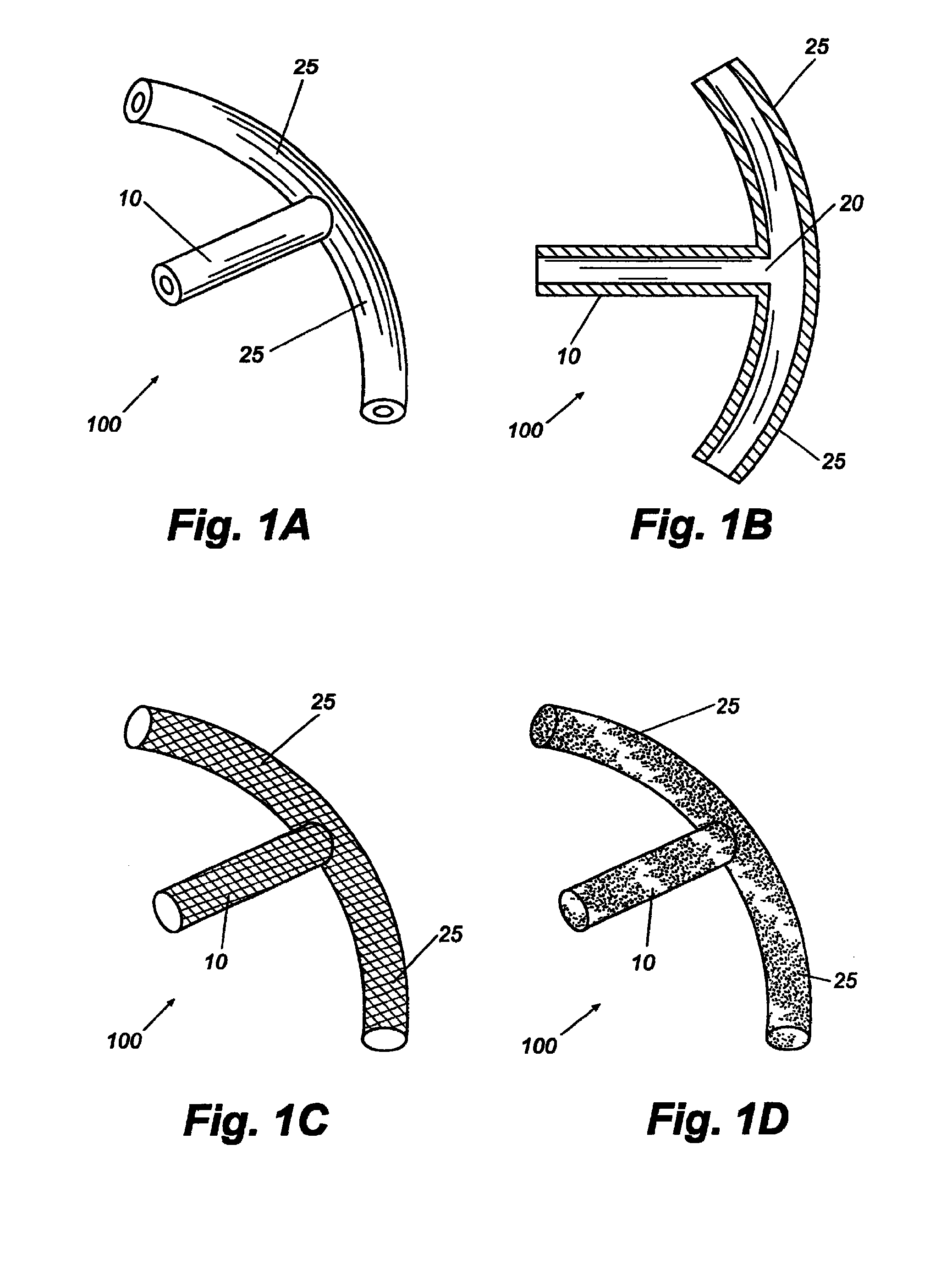 Dual drainage pathway shunt device