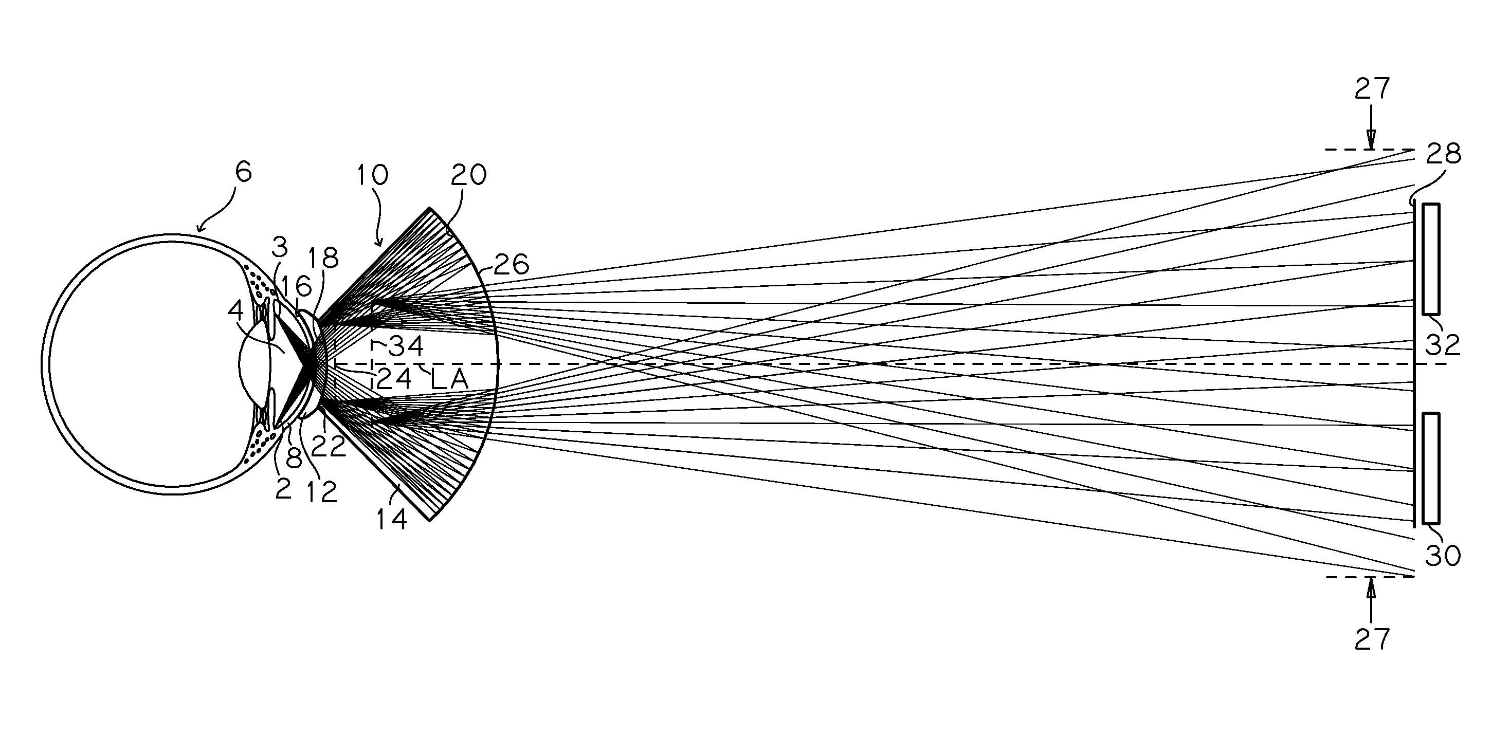 Real image forming eye examination lens utilizing two reflecting surfaces with non-mirrored central viewing area