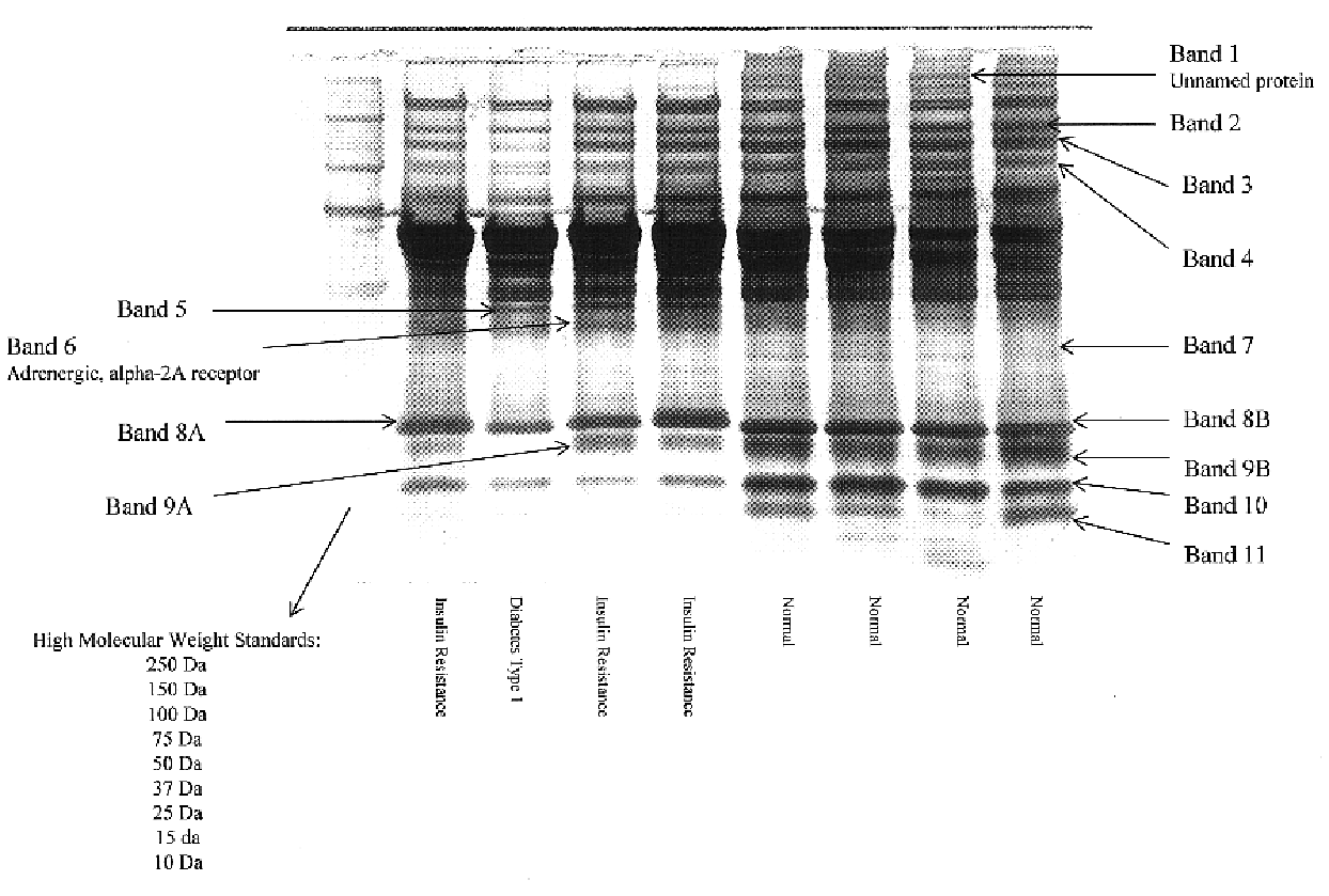 HP biopolymer markers predictive of insulin resistance