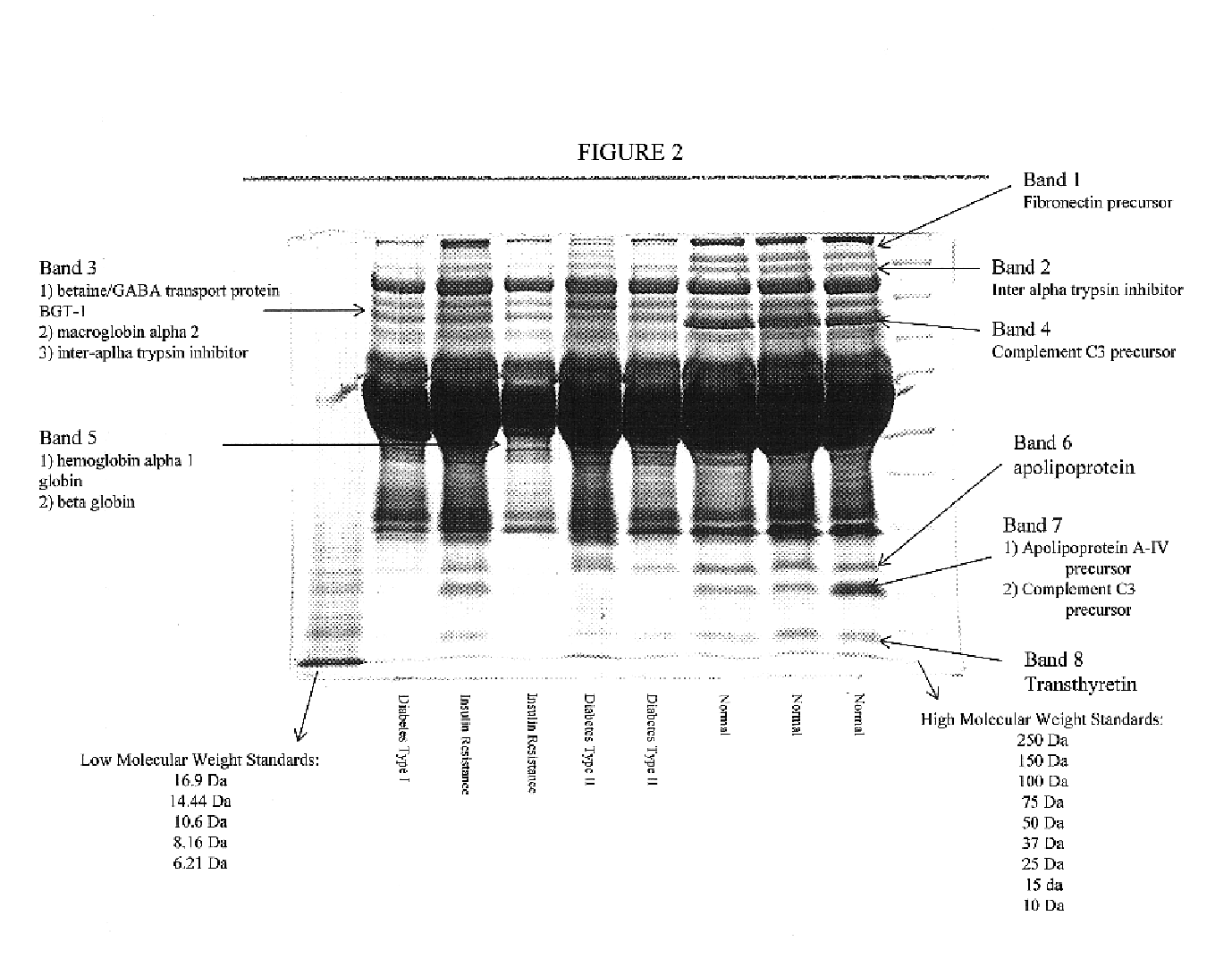 HP biopolymer markers predictive of insulin resistance