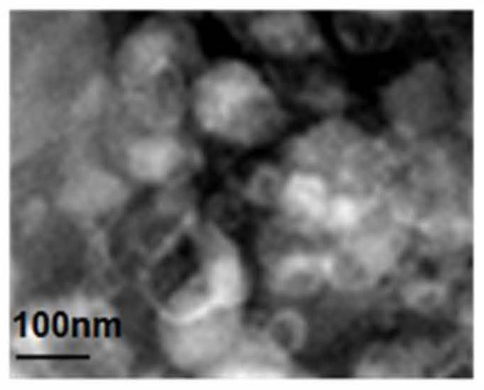 Composite drug-loaded extracellular vesicle inhalation preparation as well as preparation method and application thereof