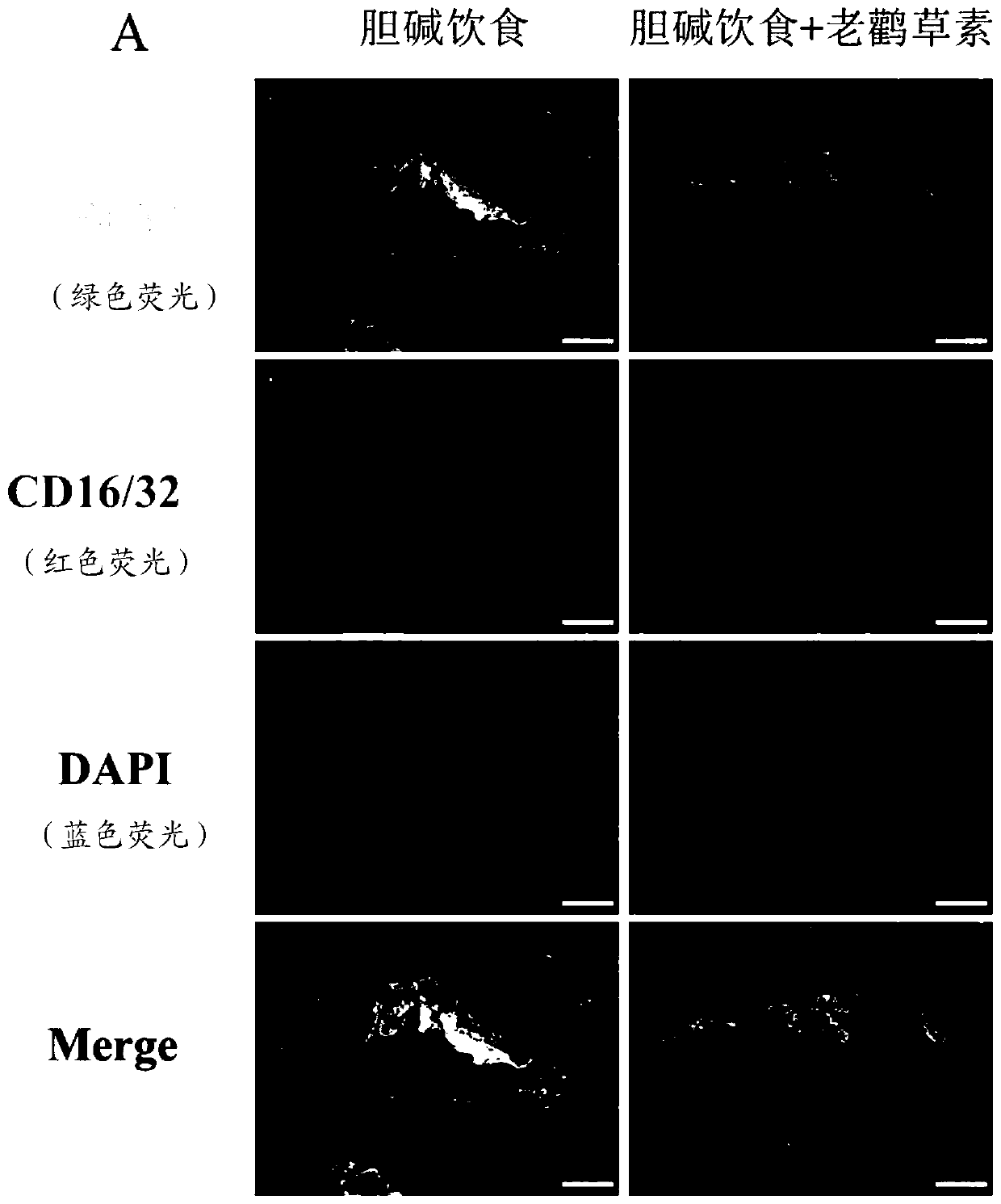 Application of geraniin in preparation of drugs to prevent or treat atherosclerosis