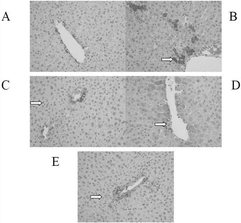 Application of psoralea corylifolia in preparation of medicine for treating children fatty liver