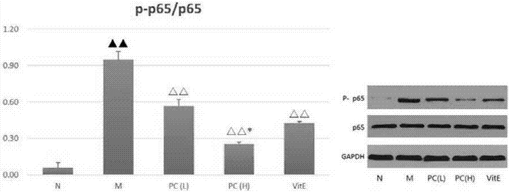 Application of psoralea corylifolia in preparation of medicine for treating children fatty liver