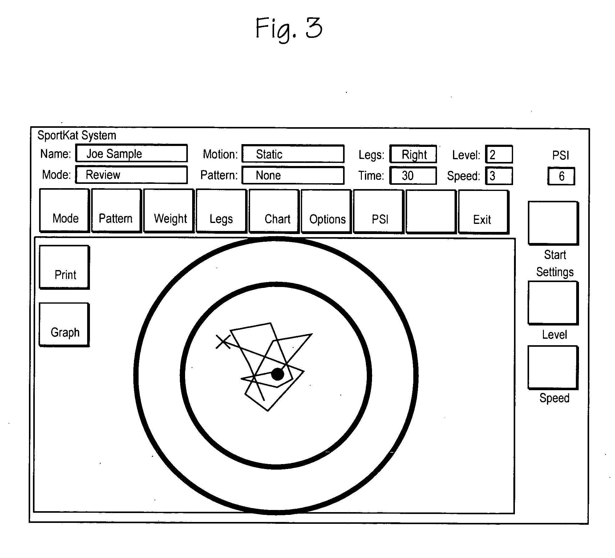 System and method of moderation of vestibular disorders