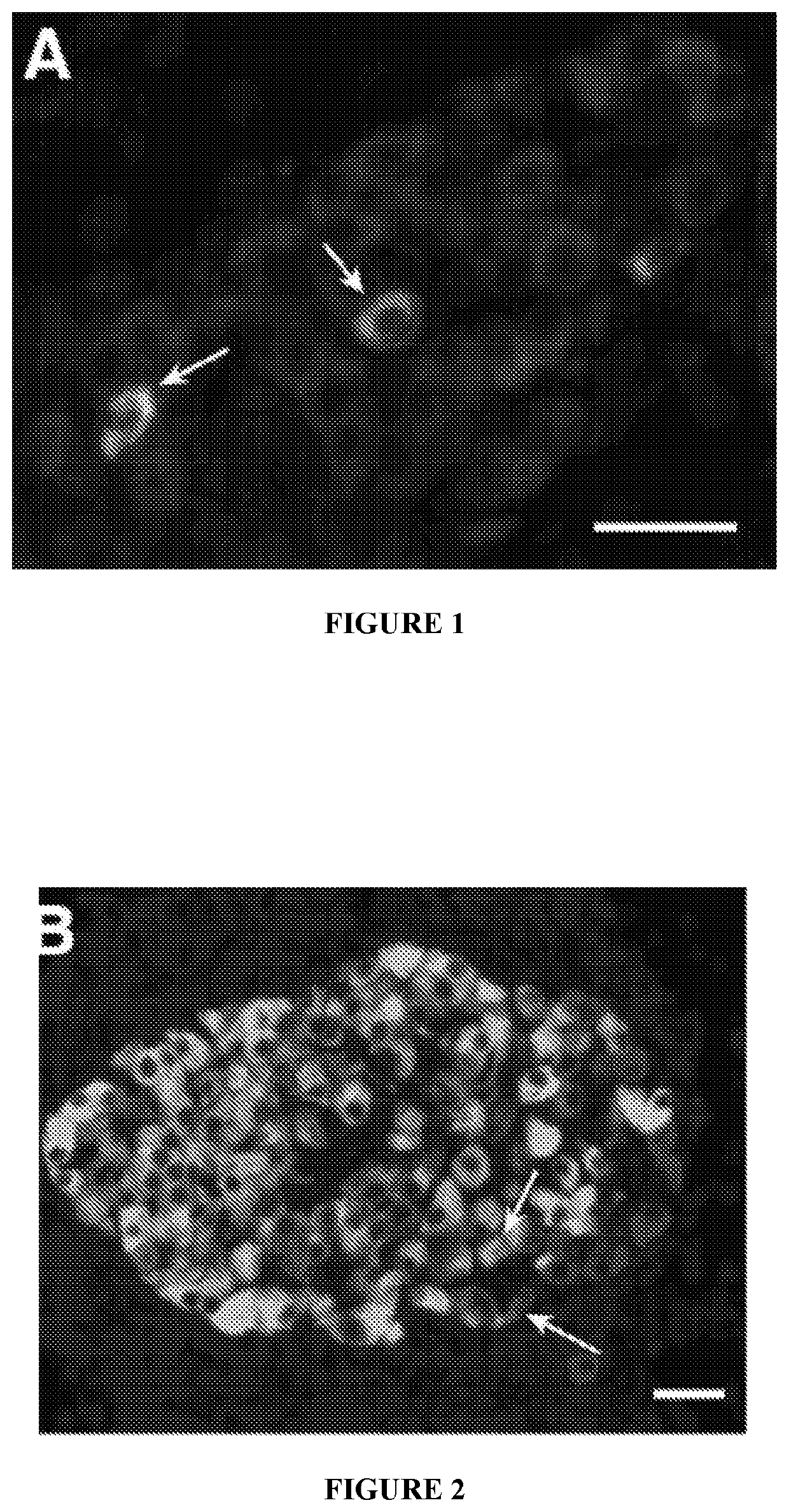 Combination therapies for treatment of inflammatory diseases