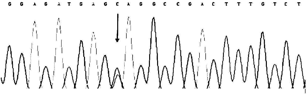 Kit for detecting mutation of sensorineural deafness pathogenic gene GJB2