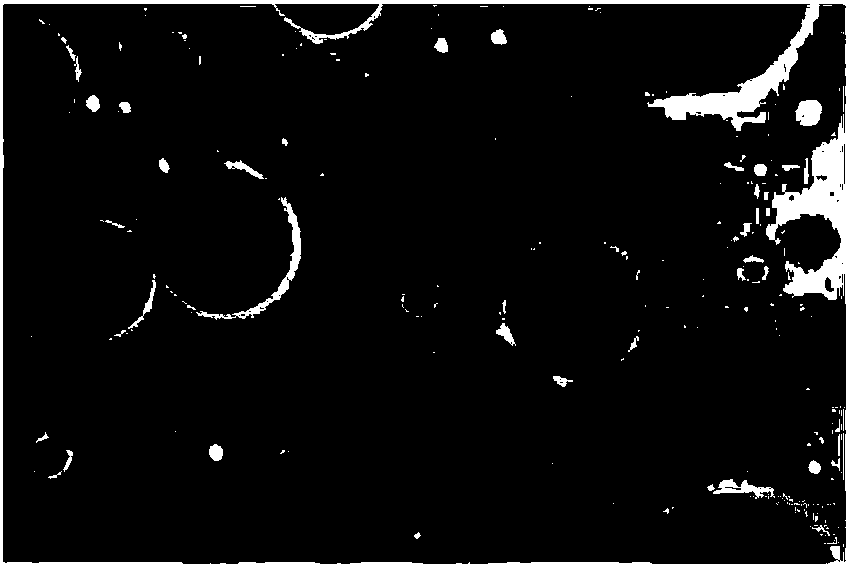 Liraglutide multivesicular liposome and preparation method and application thereof