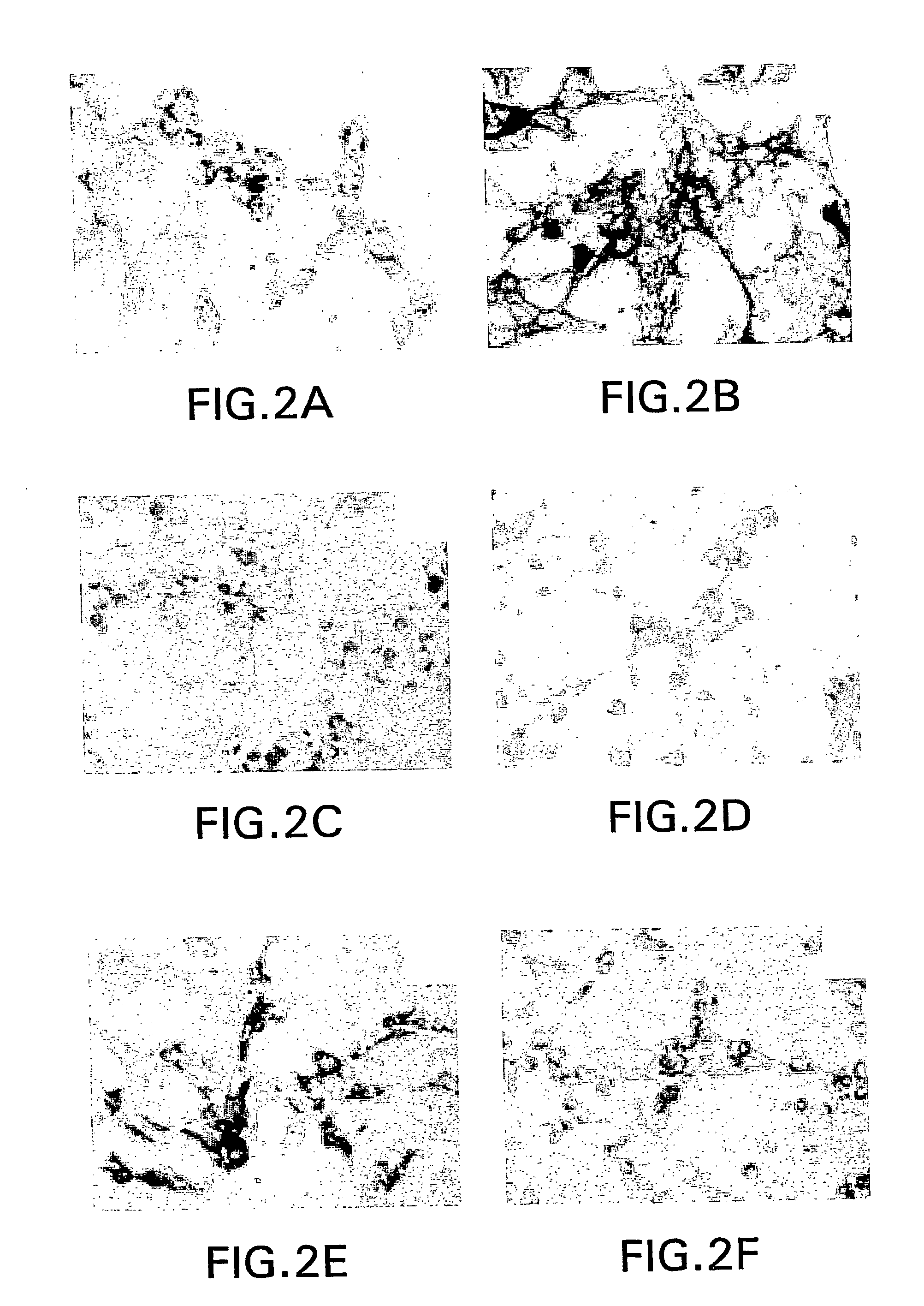 Adult human dental pulp stem cells in vitro and in vivo