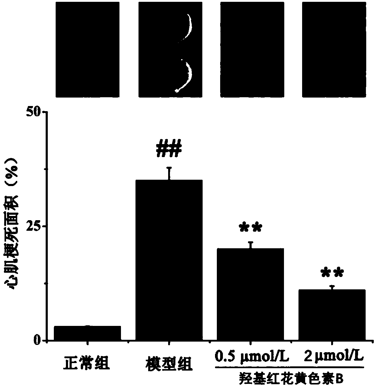 Application of hydroxysafflor yellow B in prevention and treatment of myocardial ischemia reperfusion injury